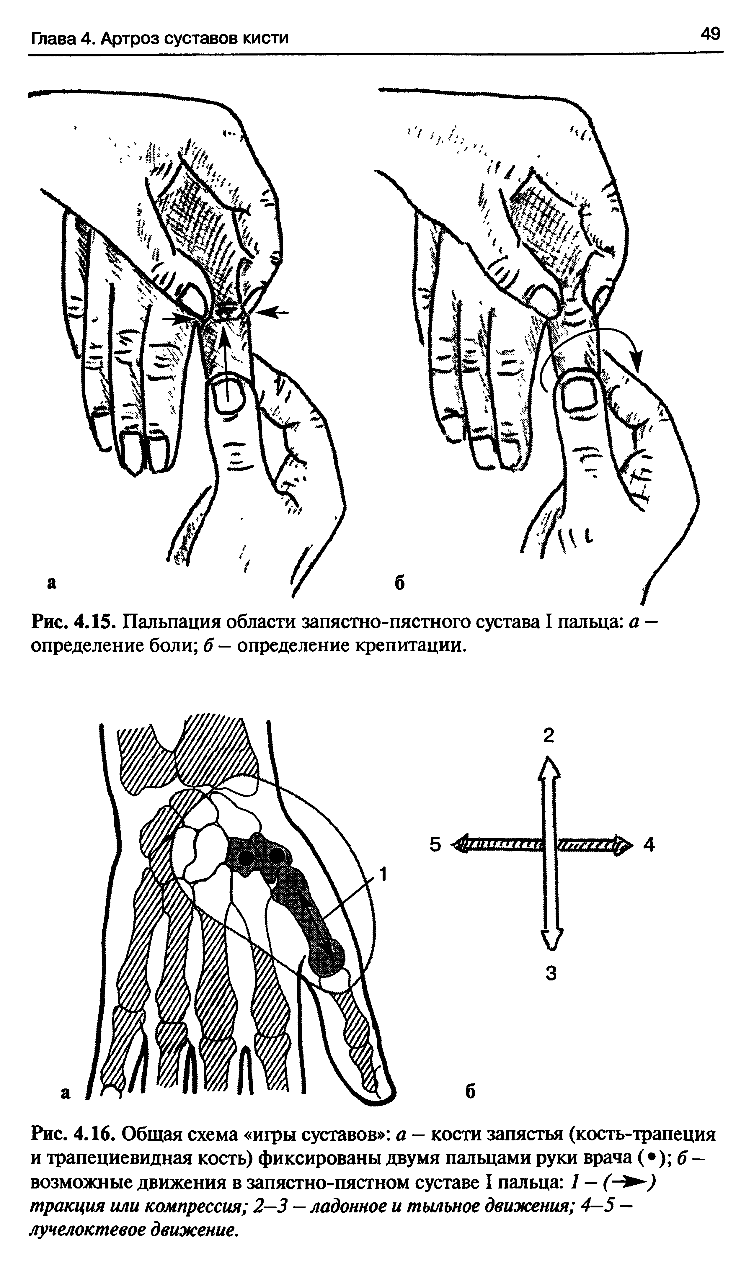 Рис. 4.16. Общая схема игры суставов а — кости запястья (кость-трапеция и трапециевидная кость) фиксированы двумя пальцами руки врача ( ) б — возможные движения в запястно-пястном суставе I пальца 1 - (- ) тракция или компрессия 2—3 — ладонное и тыльное движения 4—5 — лучелоктевое движение.