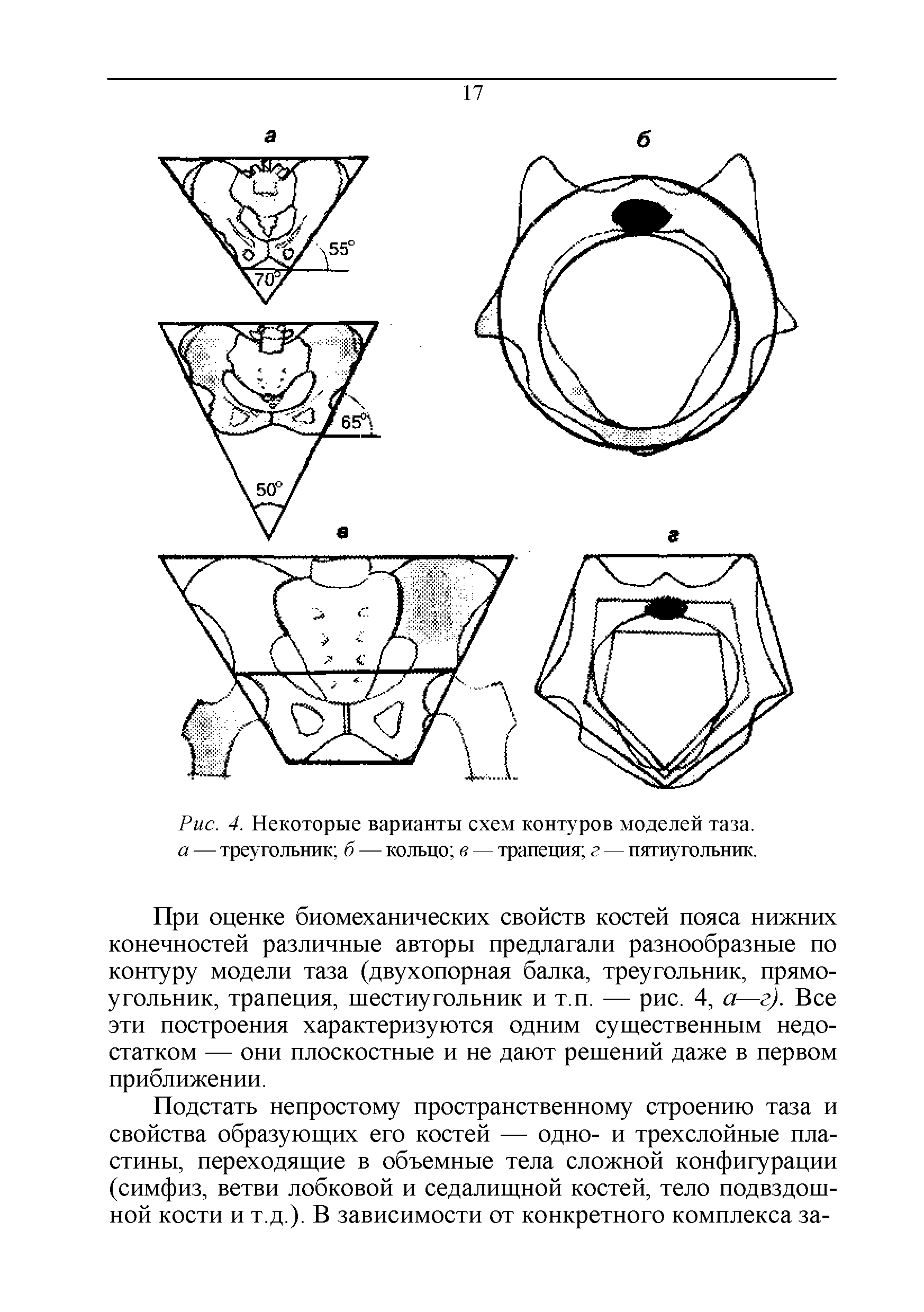 Рис. 4. Некоторые варианты схем контуров моделей таза. а — треугольник б — кольцо в — трапеция г — пятиугольник.