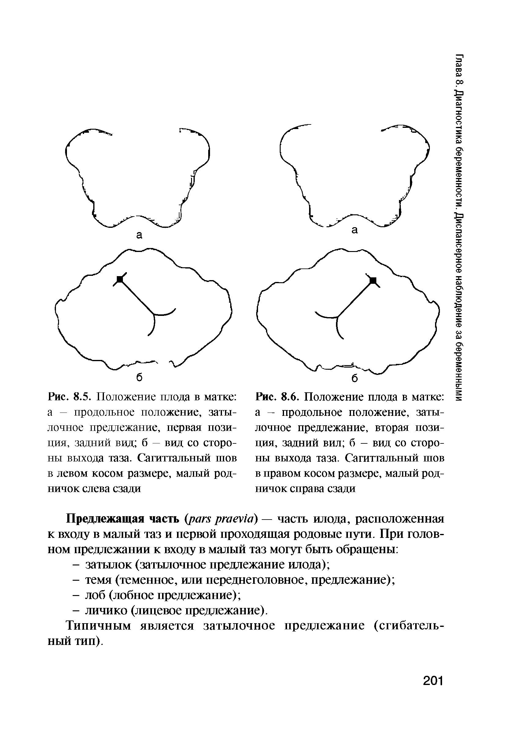 Рис. 8.5. Положение плода в матке а — продольное положение, затылочное предлежание, первая позиция, задний вид б — вид со стороны выхода таза. Сагиттальный шов в левом косом размере, малый родничок слева сзади...