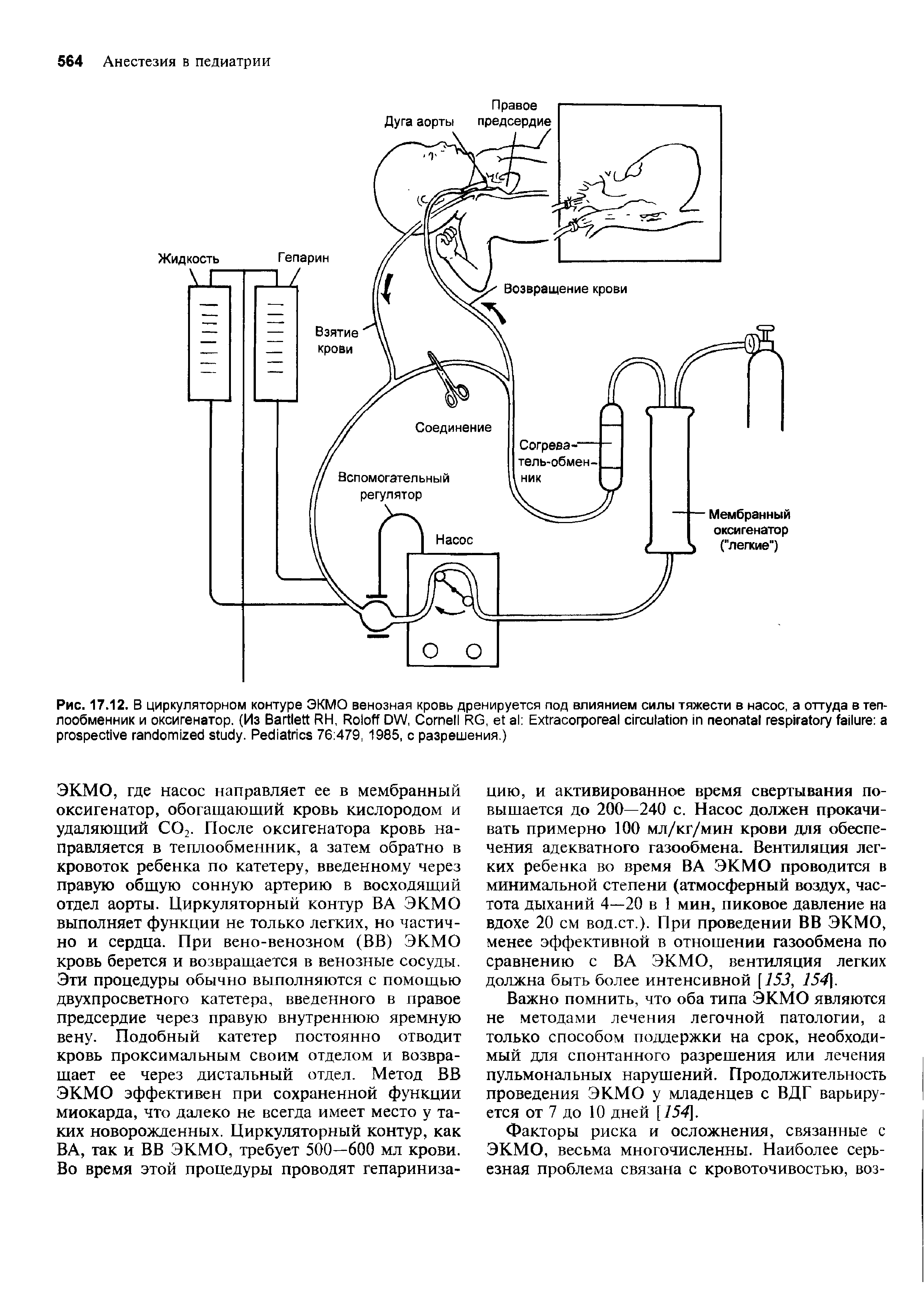 Рис. 17.12. В циркуляторном контуре ЭКМО венозная кровь дренируется под влиянием силы тяжести в насос, а оттуда в теплообменник и оксигенатор. (Из B RH, R DW, C RG, E . P 76 479, 1985, с разрешения.)...