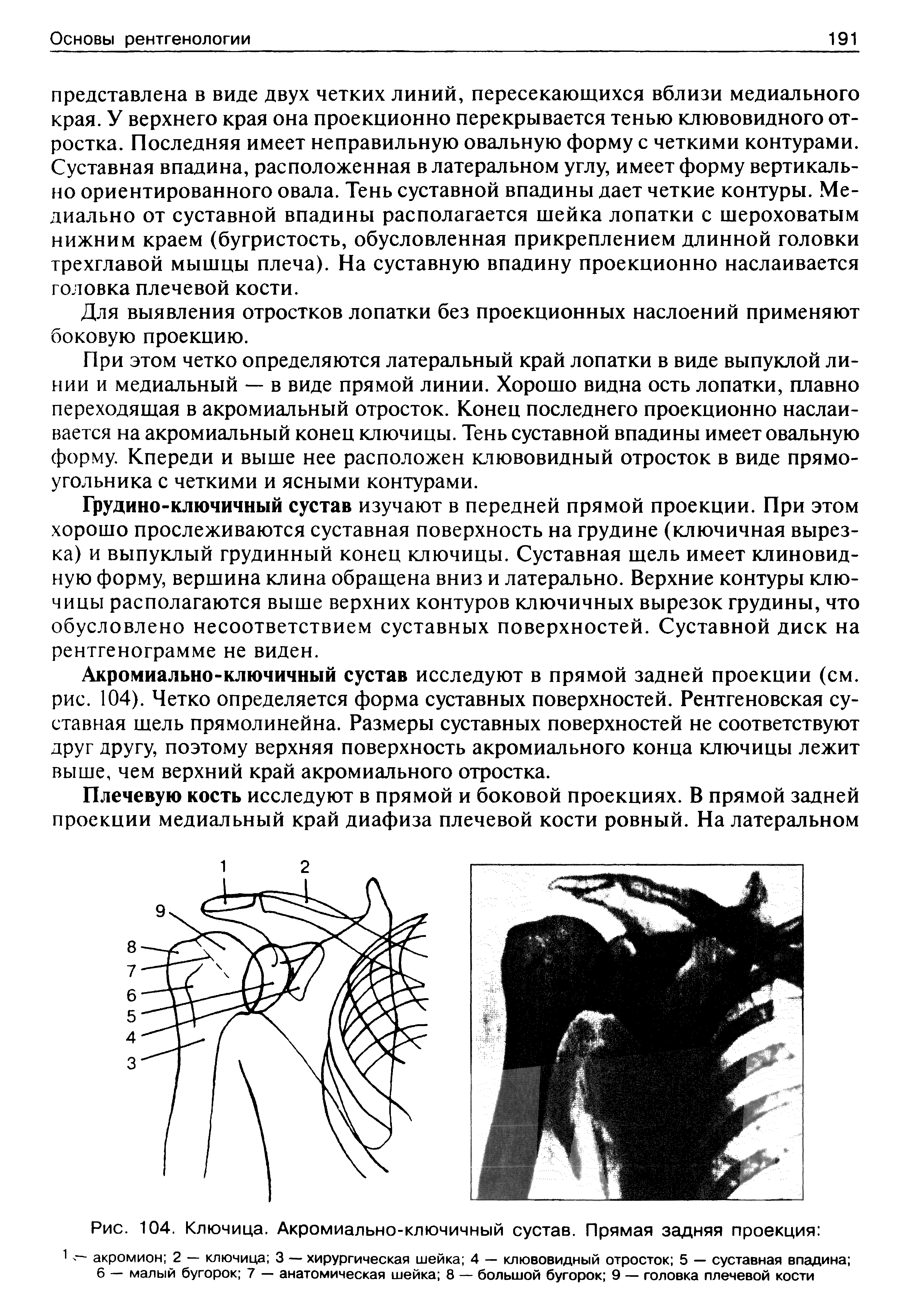 Рис. 104. Ключица. Акромиально-ключичный сустав. Прямая задняя проекция ...