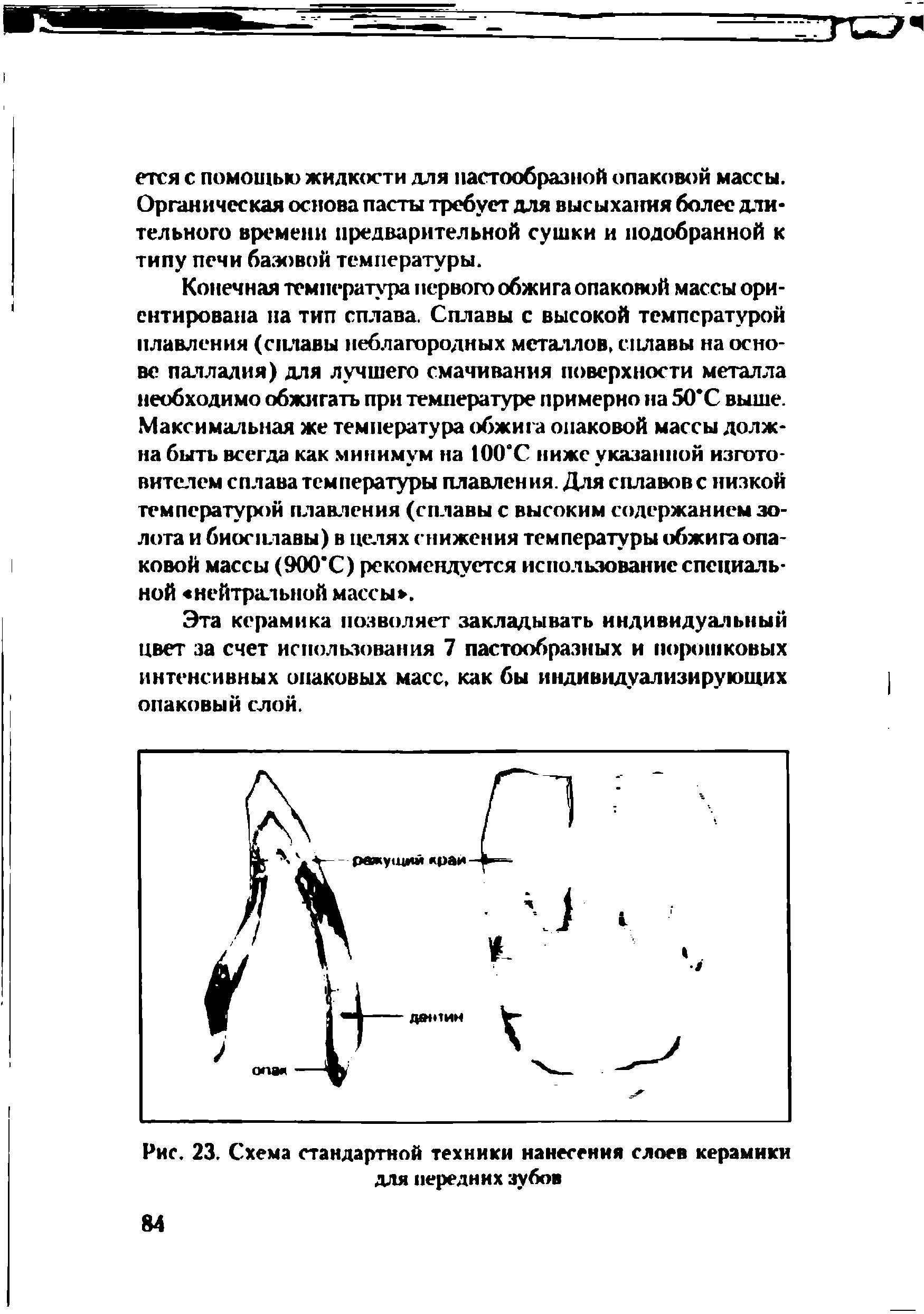 Рис. 23. Схема стандартной техники нанесения слоев керамики для передних зубов...