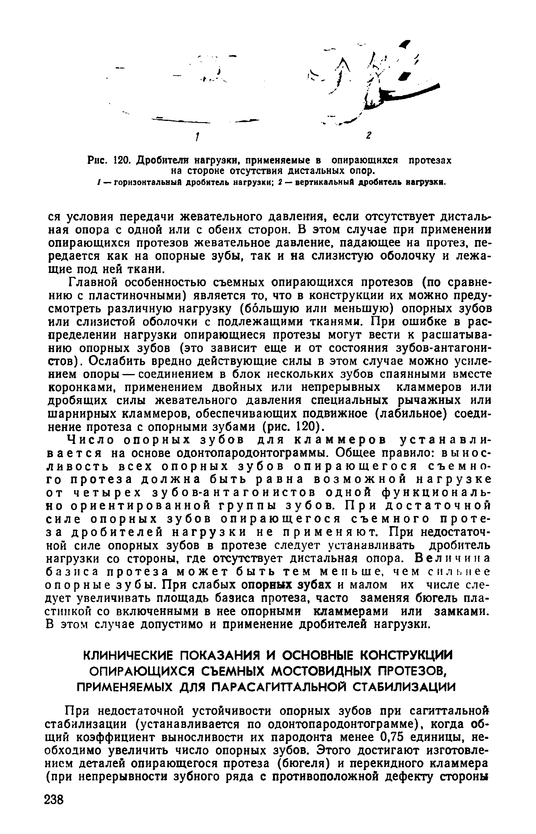 Рис. 120. Дробители нагрузки, применяемые в опирающихся протезах на стороне отсутствия дистальных опор.