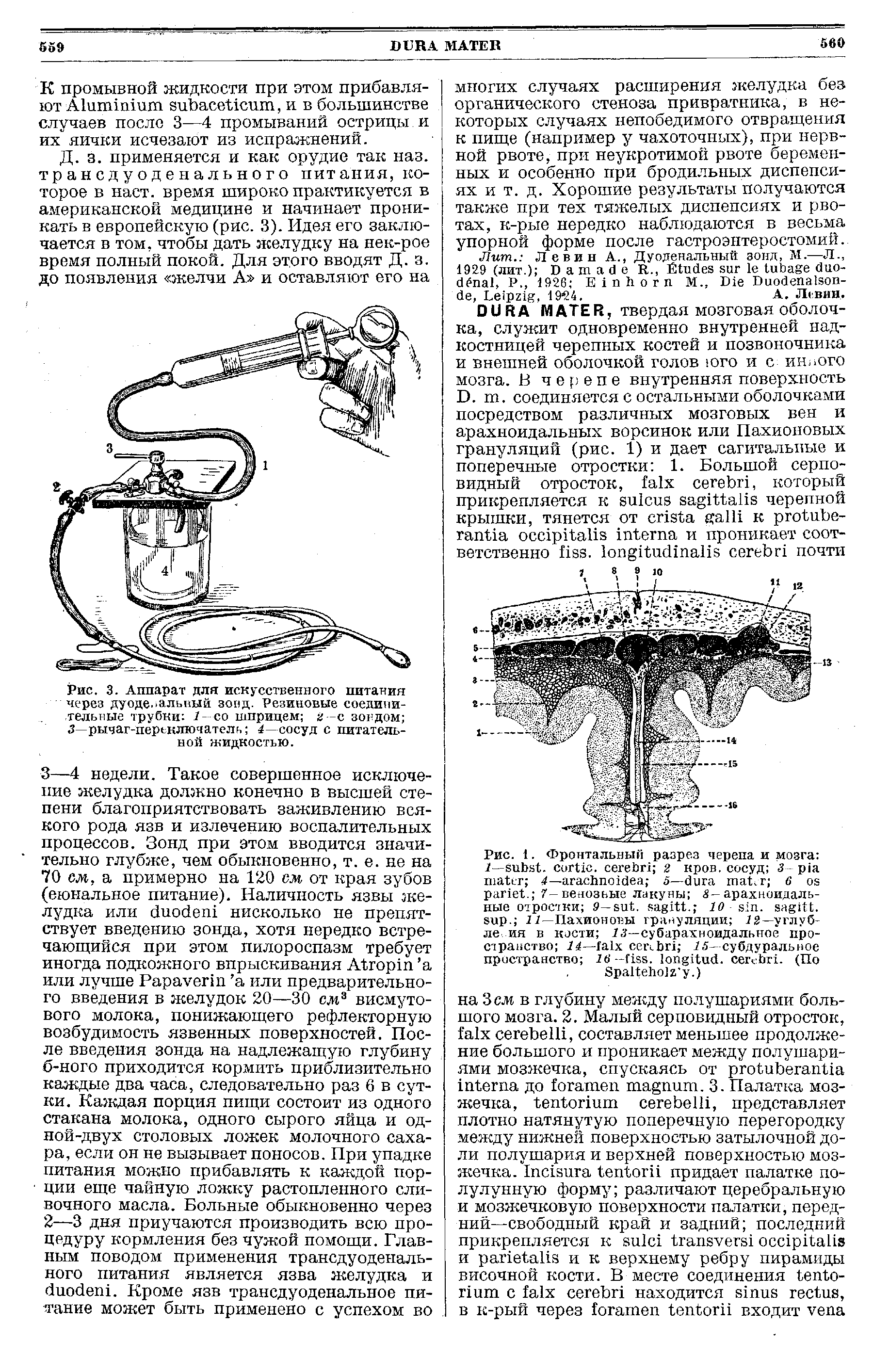 Рис. 3. Аппарат для искусственного питания через дуоденальный зонд. Резиновые соединительные трубки 1- со шприцем а -с зондом 3—рычаг-переключатель 4—сосуд с питательной жидкостью.