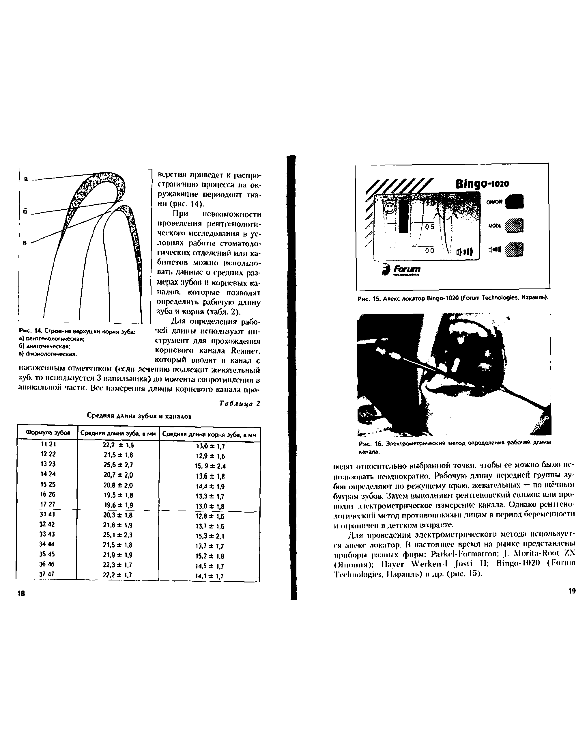 Рис. 15. Апекс локатор B -1020 (F T , Израиль).