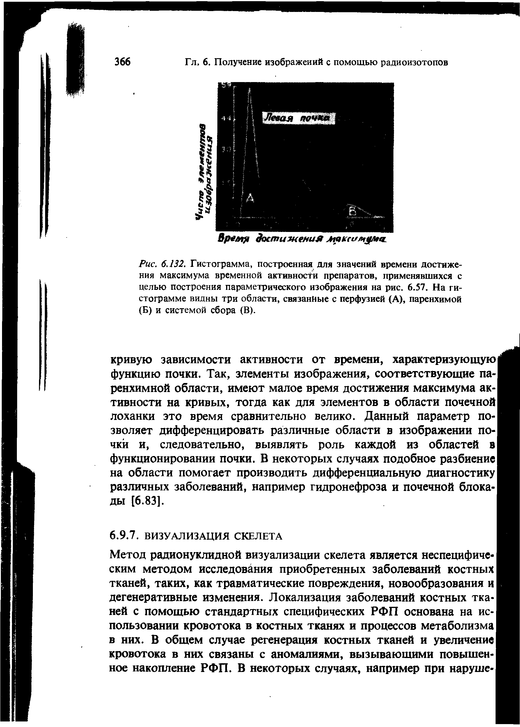 Рис. 6.132. Гистограмма, построенная для значений времени достижения максимума временной активности препаратов, применявшихся с целью построения параметрического изображения на рис. 6.57. На гистограмме видны три области, связанные с перфузией (А), паренхимой (Б) и системой сбора (В).