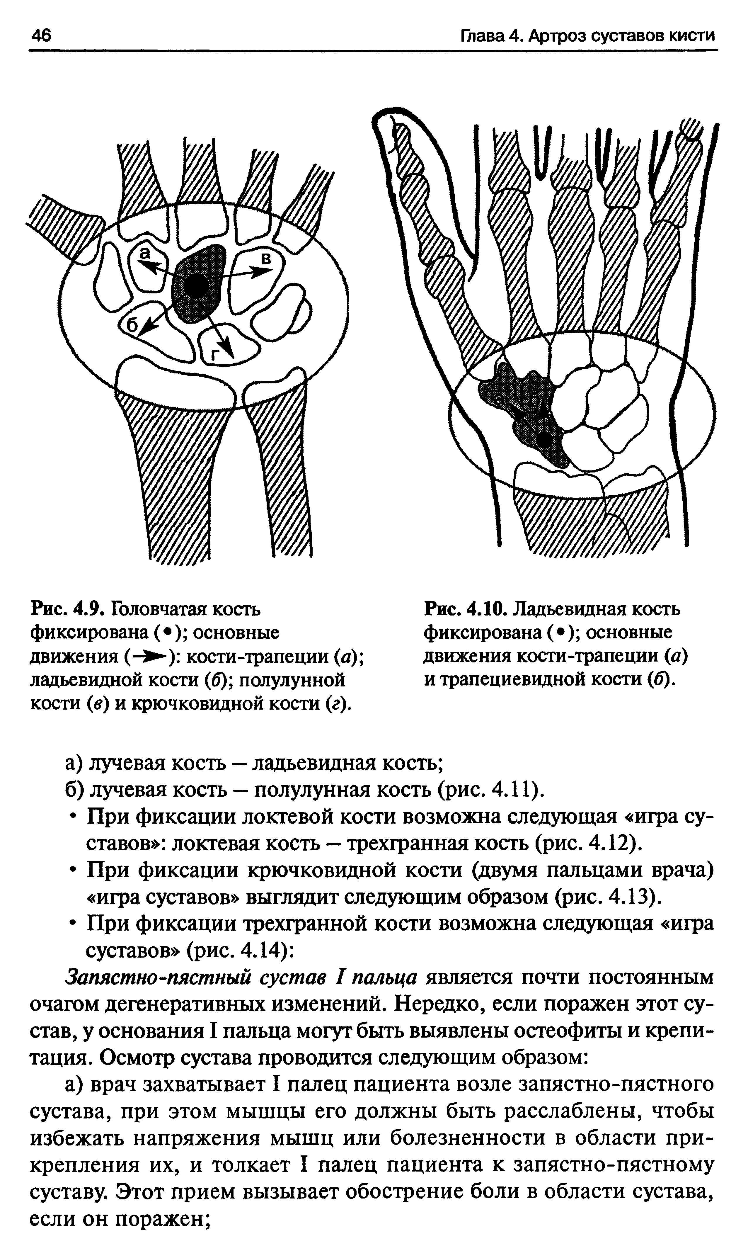 Рис. 4.10. Ладьевидная кость фиксирована ( ) основные движения кости-трапеции (а) и трапециевидной кости (б).