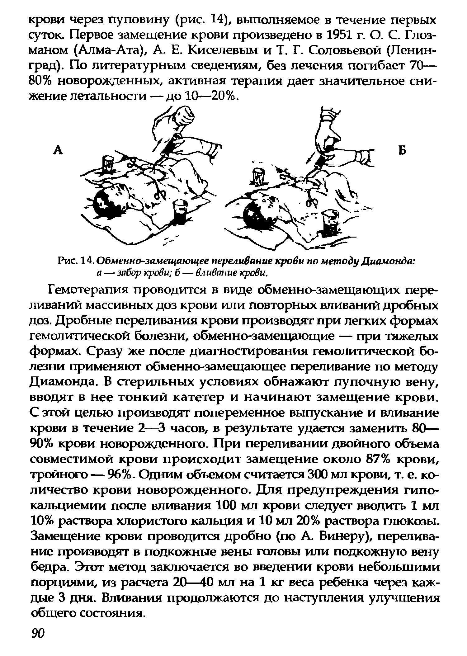 Рис. 14. Обменно-замещающее переливание крови по методу Диамонда а — забор крови б — вливание крови.