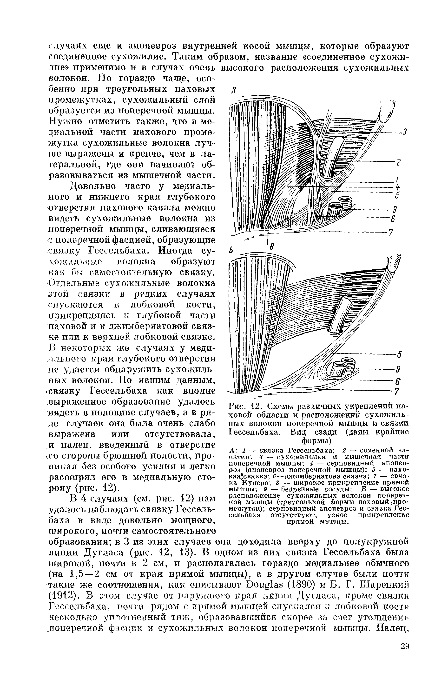 Рис. 12. Схемы различных укреплений паховой области и расположений сухожильных волокон поперечной мышцы и связки Гессельбаха. Вид сзади (даны крайние формы).