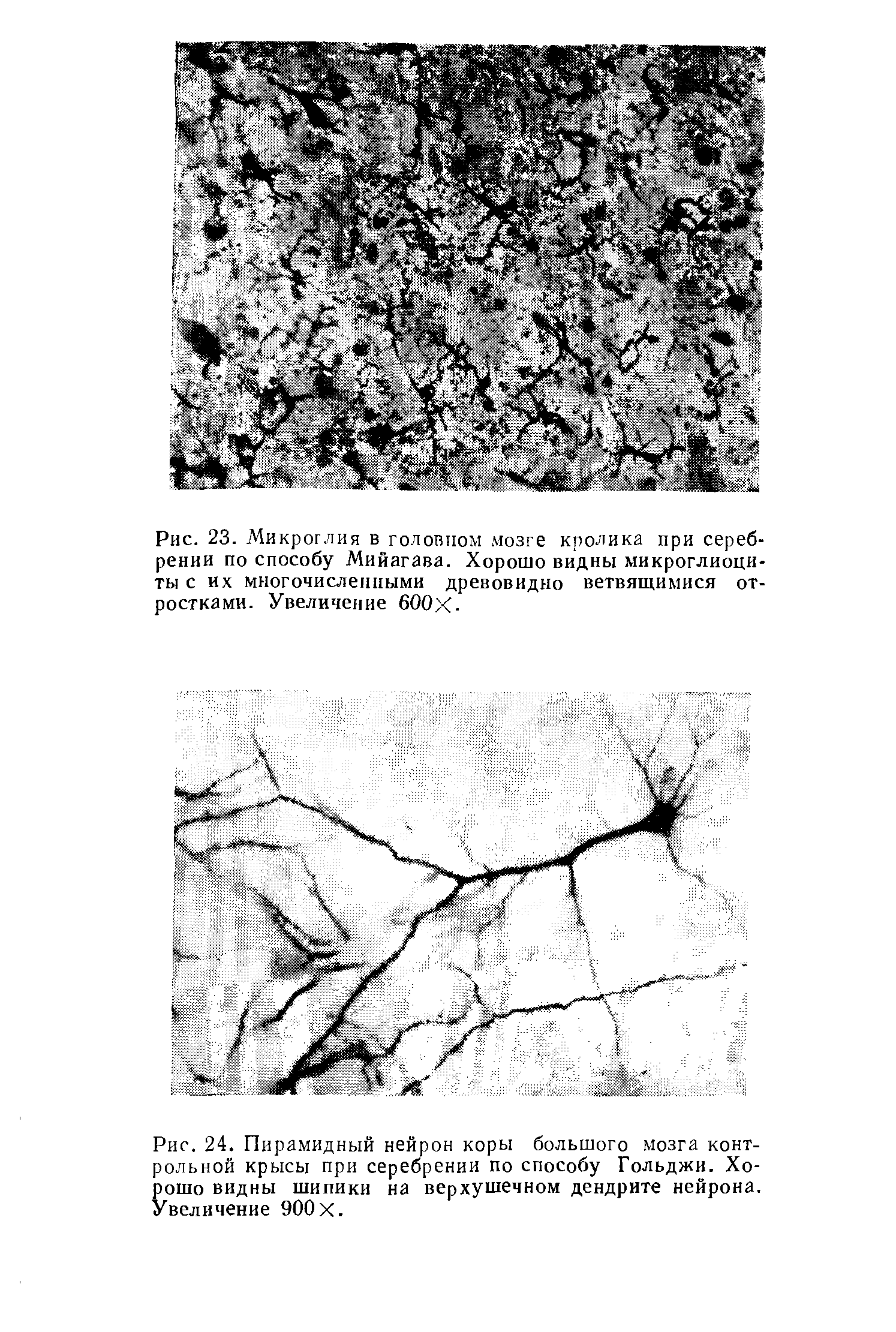 Рис. 24. Пирамидный нейрон коры большого мозга контрольной крысы при серебрении по способу Гольджи. Хорошо видны шипики на верхушечном дендрите нейрона. Увеличение 900 X.