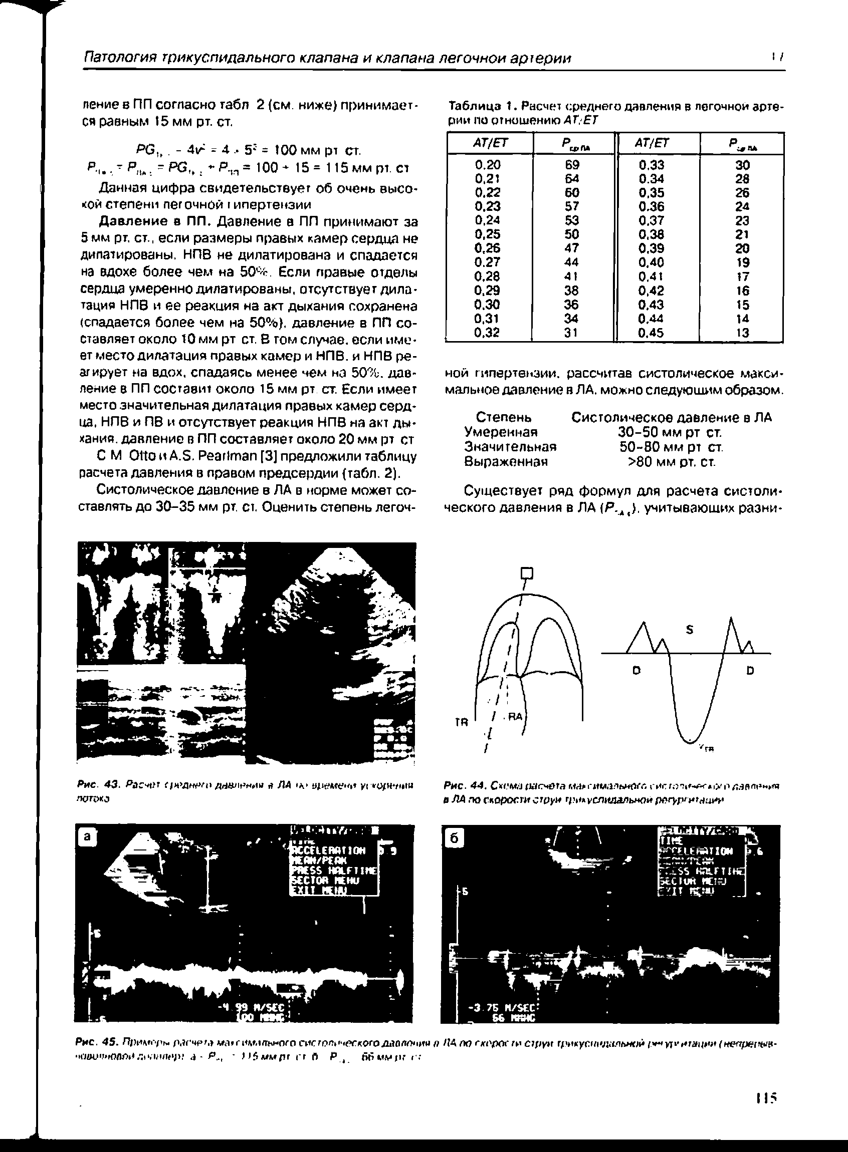 Рис. 45. Прнмс-ры рагчр а м/ипчмлы-ого систол ческогодаоло<1им я ПАгюоа рскги орун цшкусмадделим /. кг нгацни нелрепып а- > 5ммрг гг п Р бьм р< ...