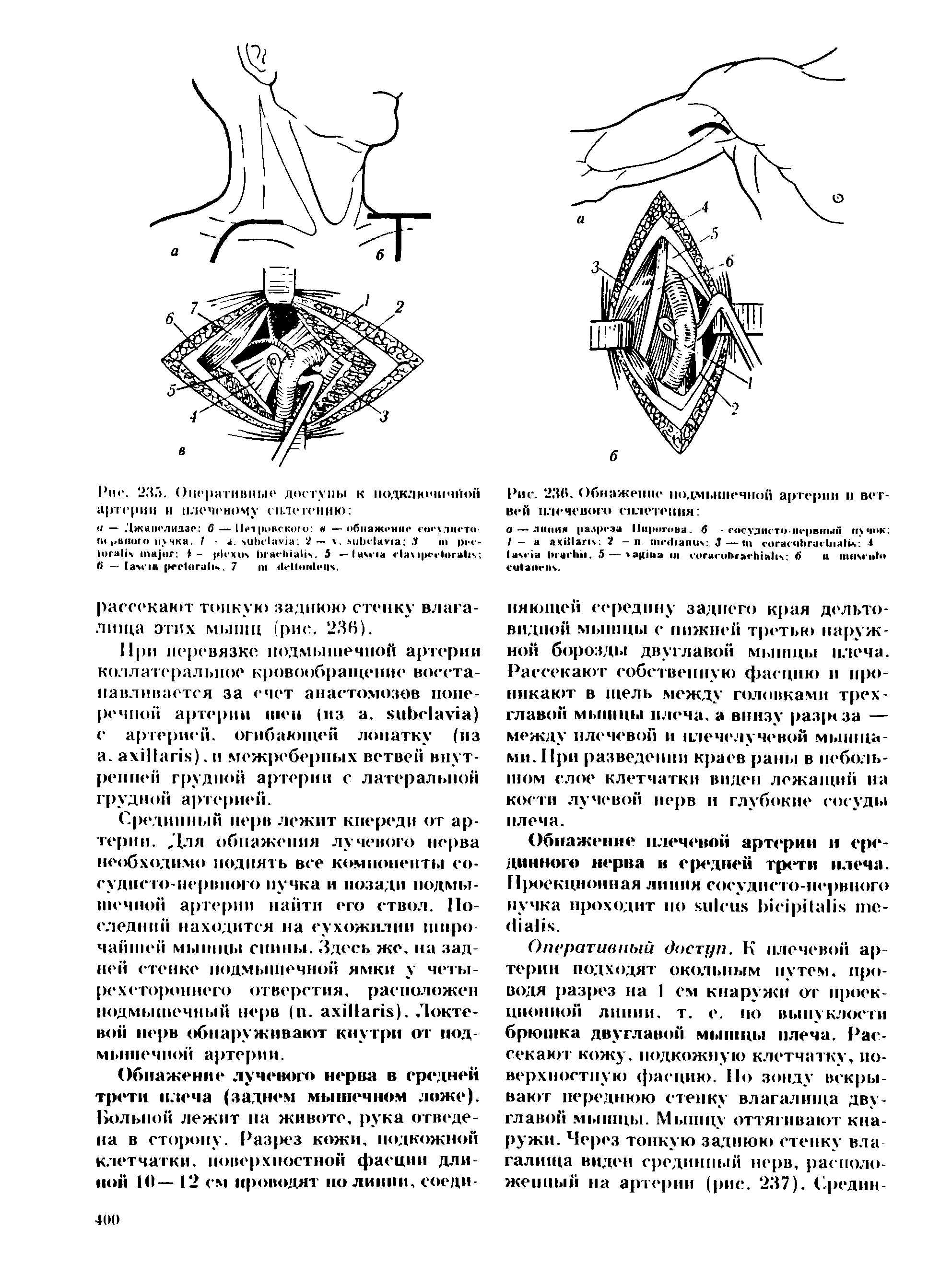 Рис. 231 . Обнажение подмышечной артерии и ветвей плечевого силе гения ...