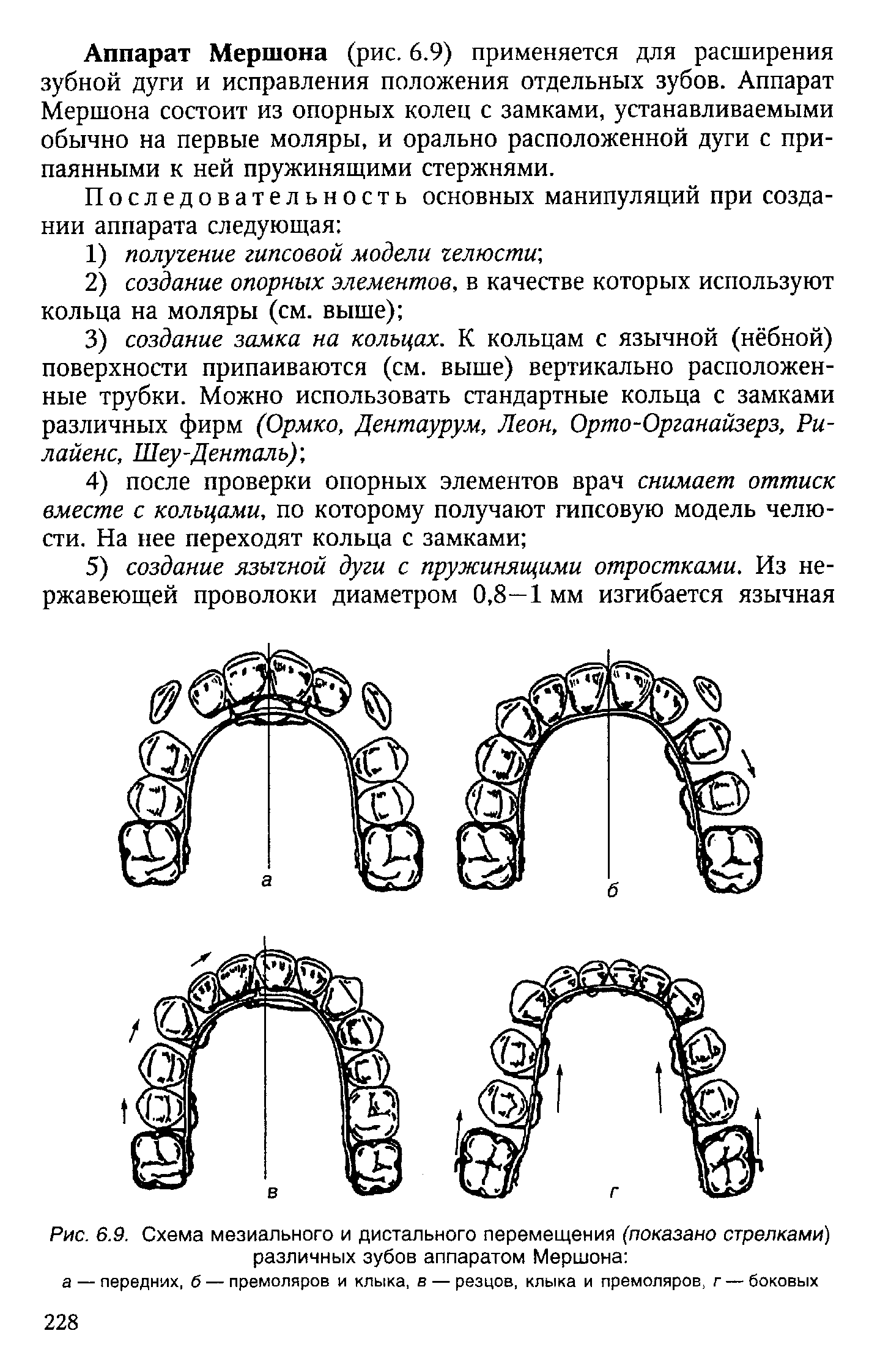 Рис. 6.9. Схема мезиального и дистального перемещения (показано стрелками) различных зубов аппаратом Мершона ...