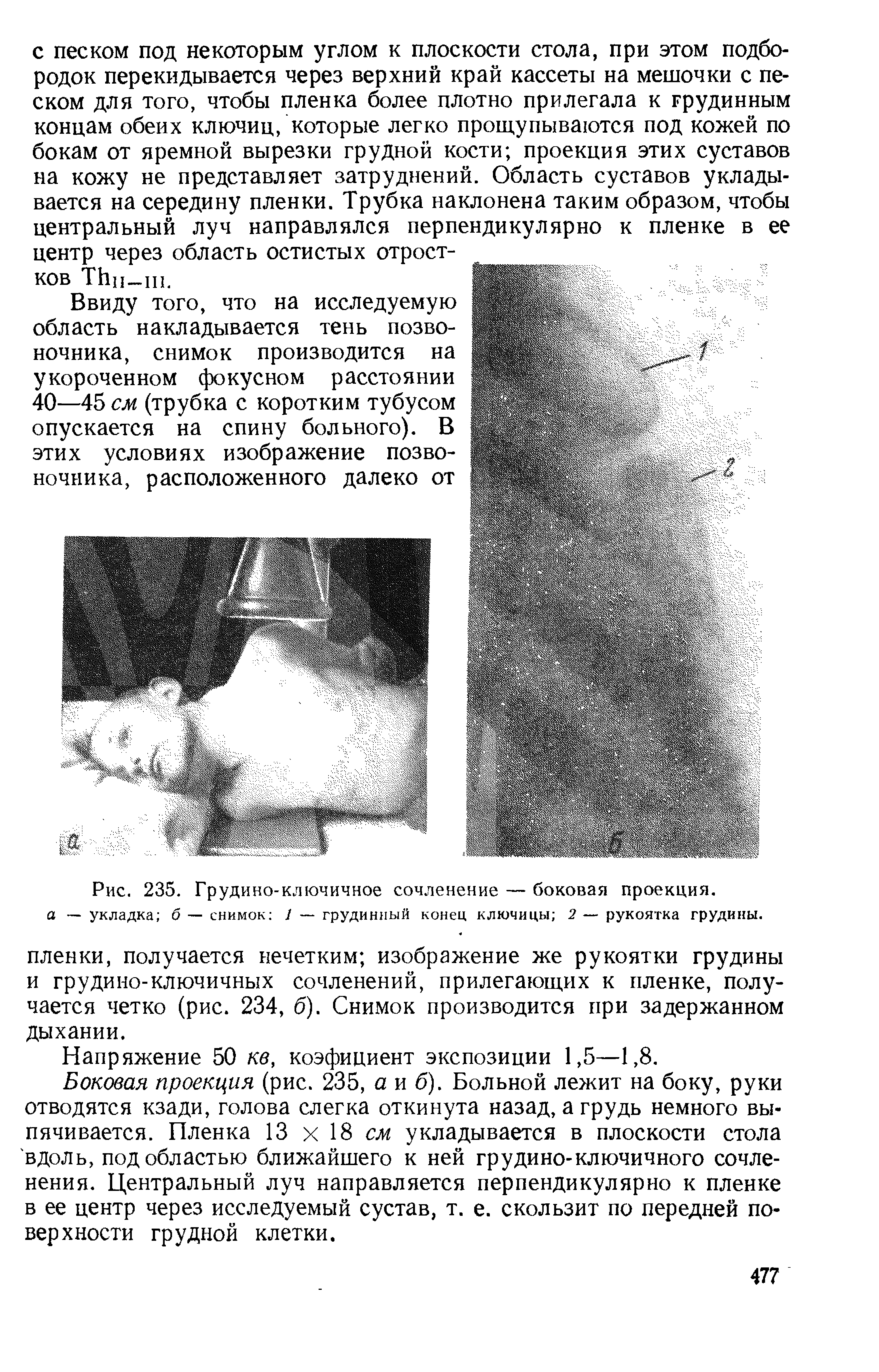 Рис. 235. Грудино-ключичное сочленение — боковая проекция. а — укладка б — снимок 1 — грудинный конец ключицы 2 — рукоятка грудины.