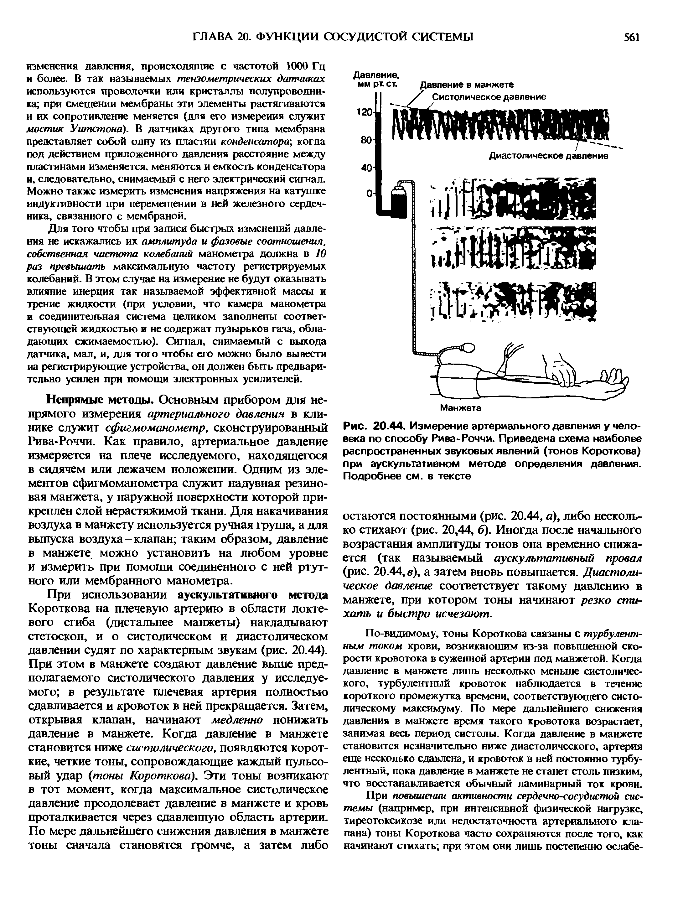 Рис. 20.44. Измерение артериального давления у человека по способу Рива-Роччи. Приведена схема наиболее распространенных звуковых явлений (тонов Короткова) при аускультативном методе определения давления. Подробнее см. в тексте...
