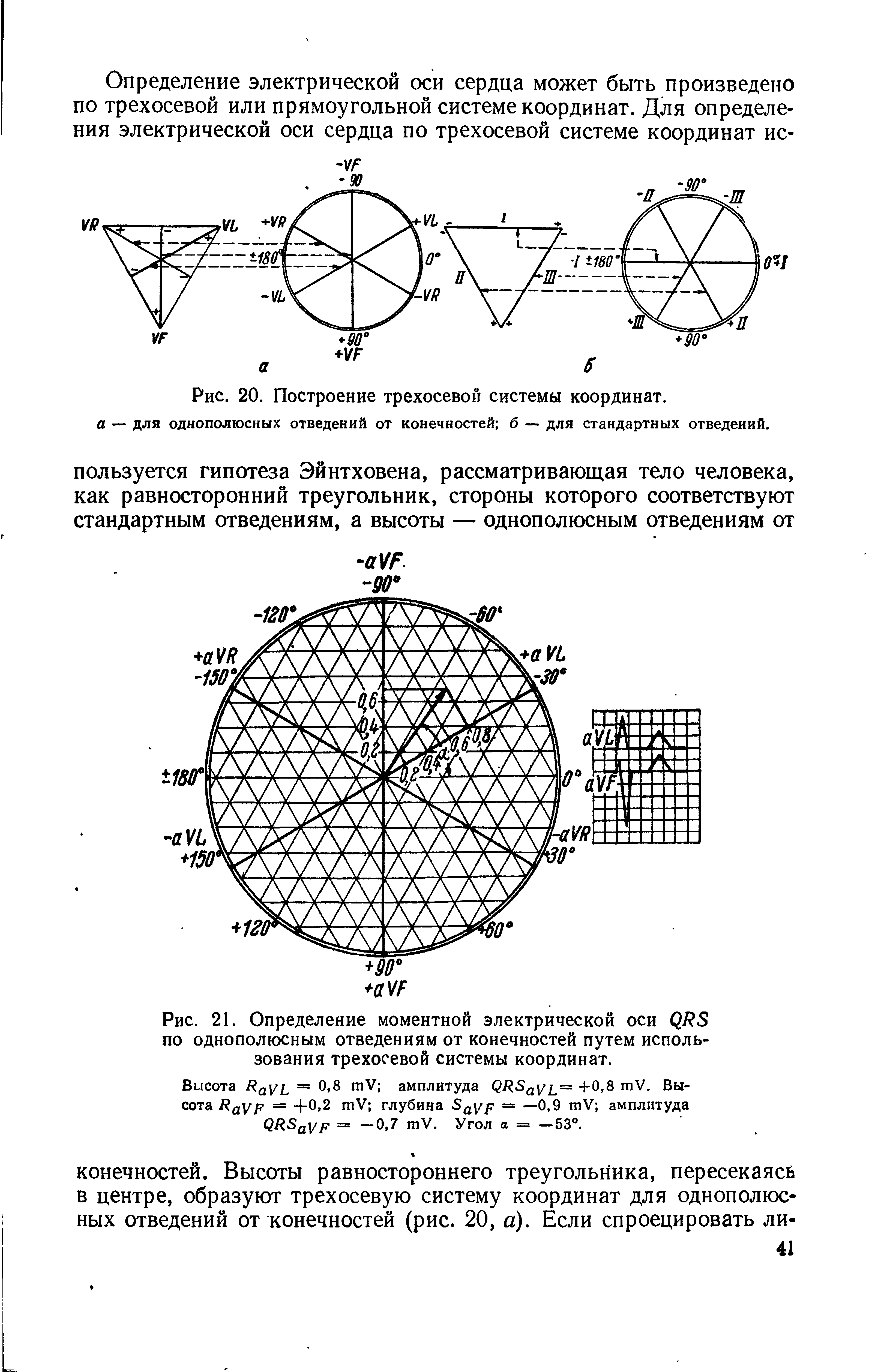 Рис. 21. Определение моментной электрической оси по однополюсным отведениям от конечностей путем использования трехосевой системы координат.