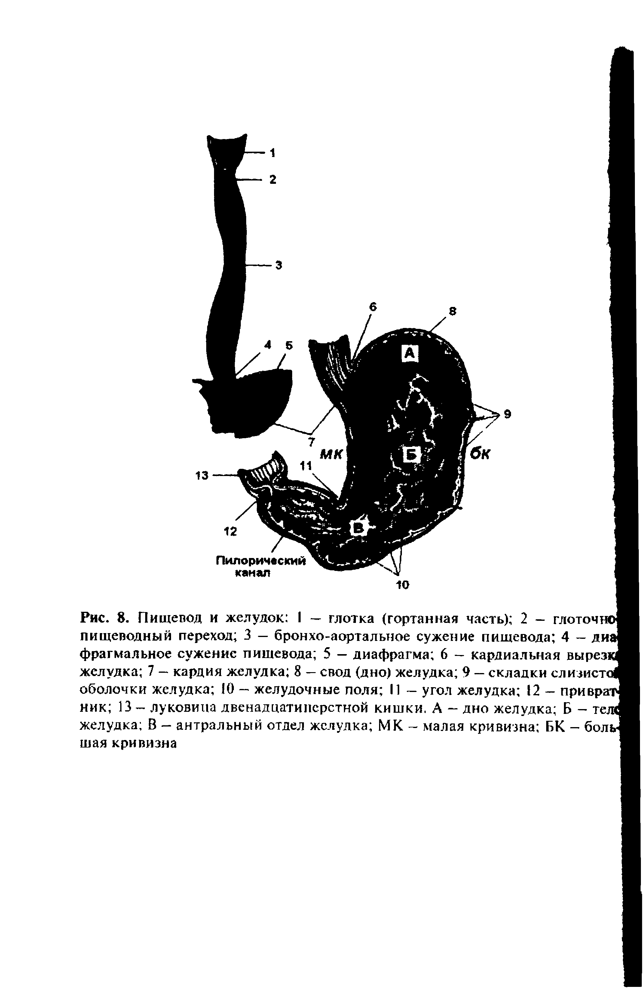 Рис. 8. Пищевод и желудок I — глотка (гортанная часть) 2 — глоточно пищеводный переход 3 — бронхо-аортальное сужение пищевода 4 — диа фрагмальное сужение пищевода 5 — диафрагма 6 - кардиальная вырезк желудка 7 — кардия желудка 8 — свод (дно) желудка 9 — складки слизиста оболочки желудка Ю — желудочные поля II — угол желудка 12 - приврат ник 13 — луковииа двенадцатиперстной кишки. А — дно желудка Б — тел желудка В — антральный отдел желудка МК - малая кривизна БК - боль шая кривизна...