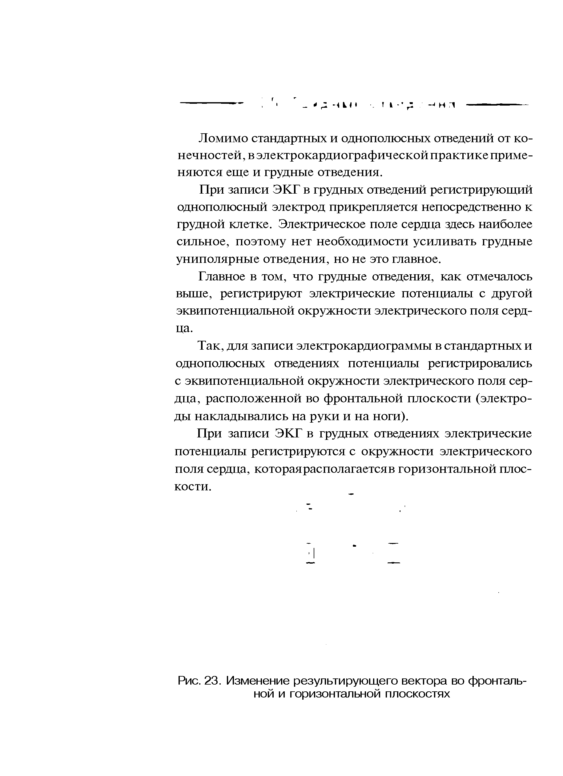 Рис. 23. Изменение результирующего вектора во фронтальной и горизонтальной плоскостях...