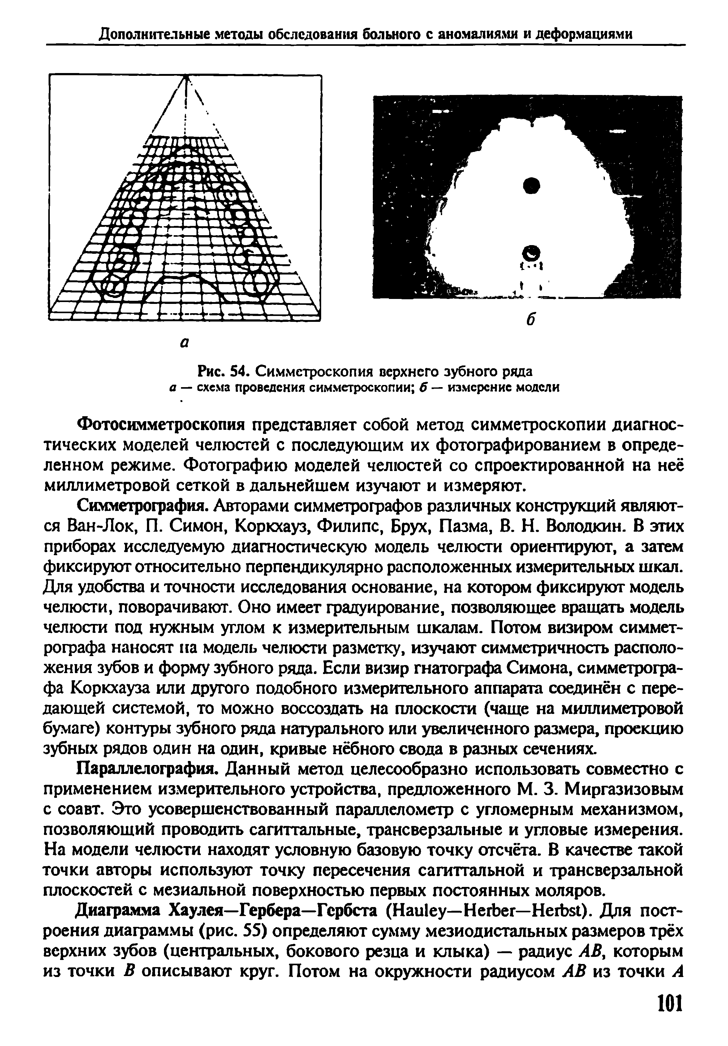 Рис. 54. Симметроскопия верхнего зубного ряда а — схема проведения симметроскопии б — измерение модели...