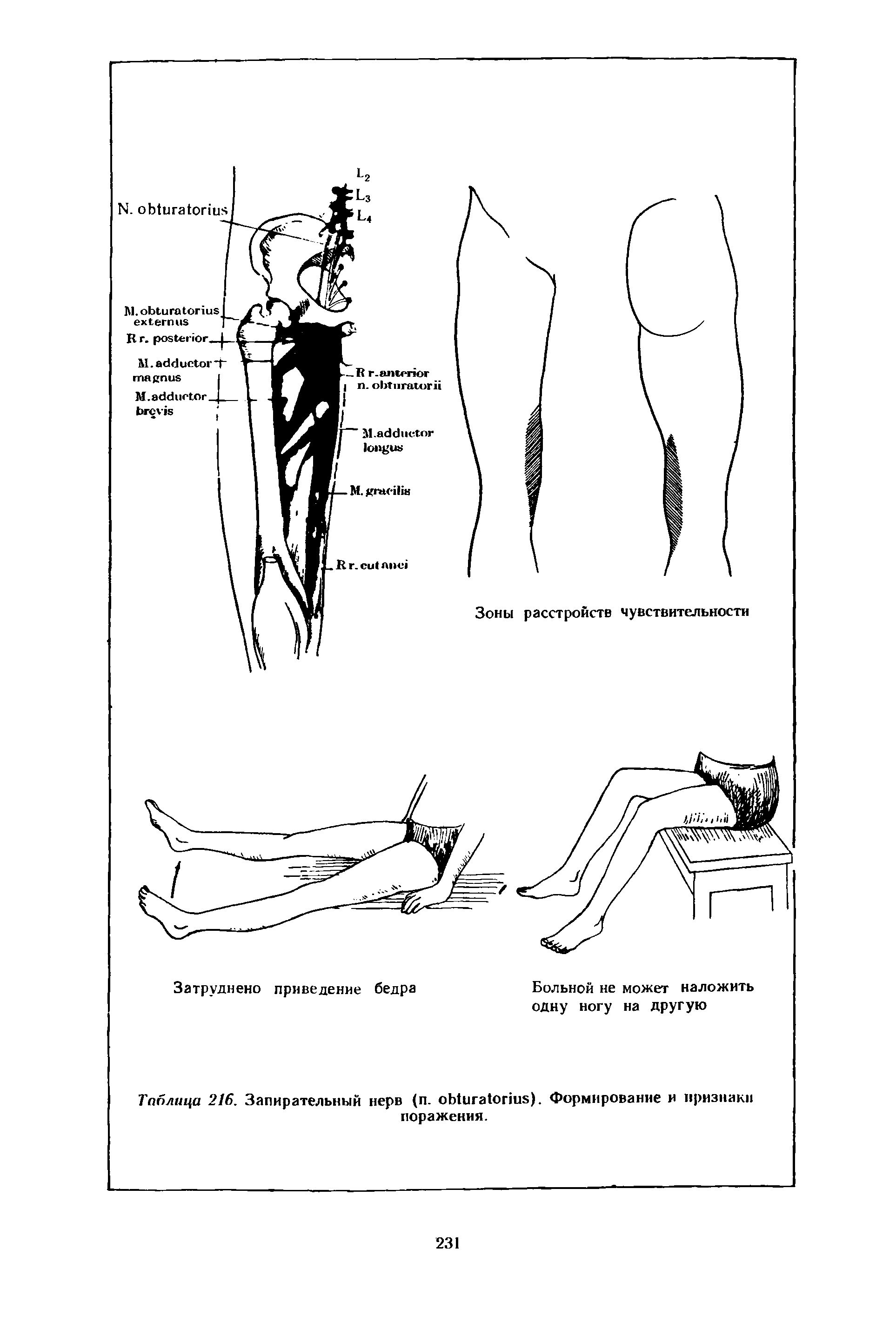 Таблица 216. Запирательный нерв (п. оЫига гшв). Формирование и признаки поражения.