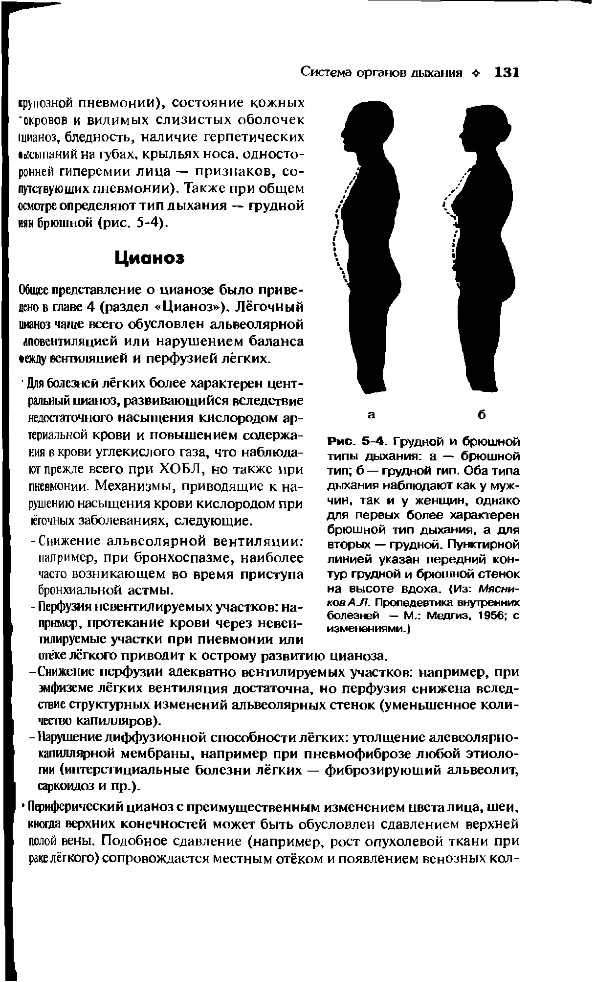 Рис. 5-4. Грудной и брюшной типы дыхания а — брюшной тип б — грудной тип. Оба типа дыхания наблюдают как у мужчин, так и у женщин, однако для первых более характерен брюшной тип дыхания, а для вторых — грудной. Пунктирной линией указан передний контур грудной и брюшной стенок на высоте вдоха. (Из Мясни-ковАЛ. Пропедевтика внутренних болезней — М. Медгиз, 1956 с изменениями.)...