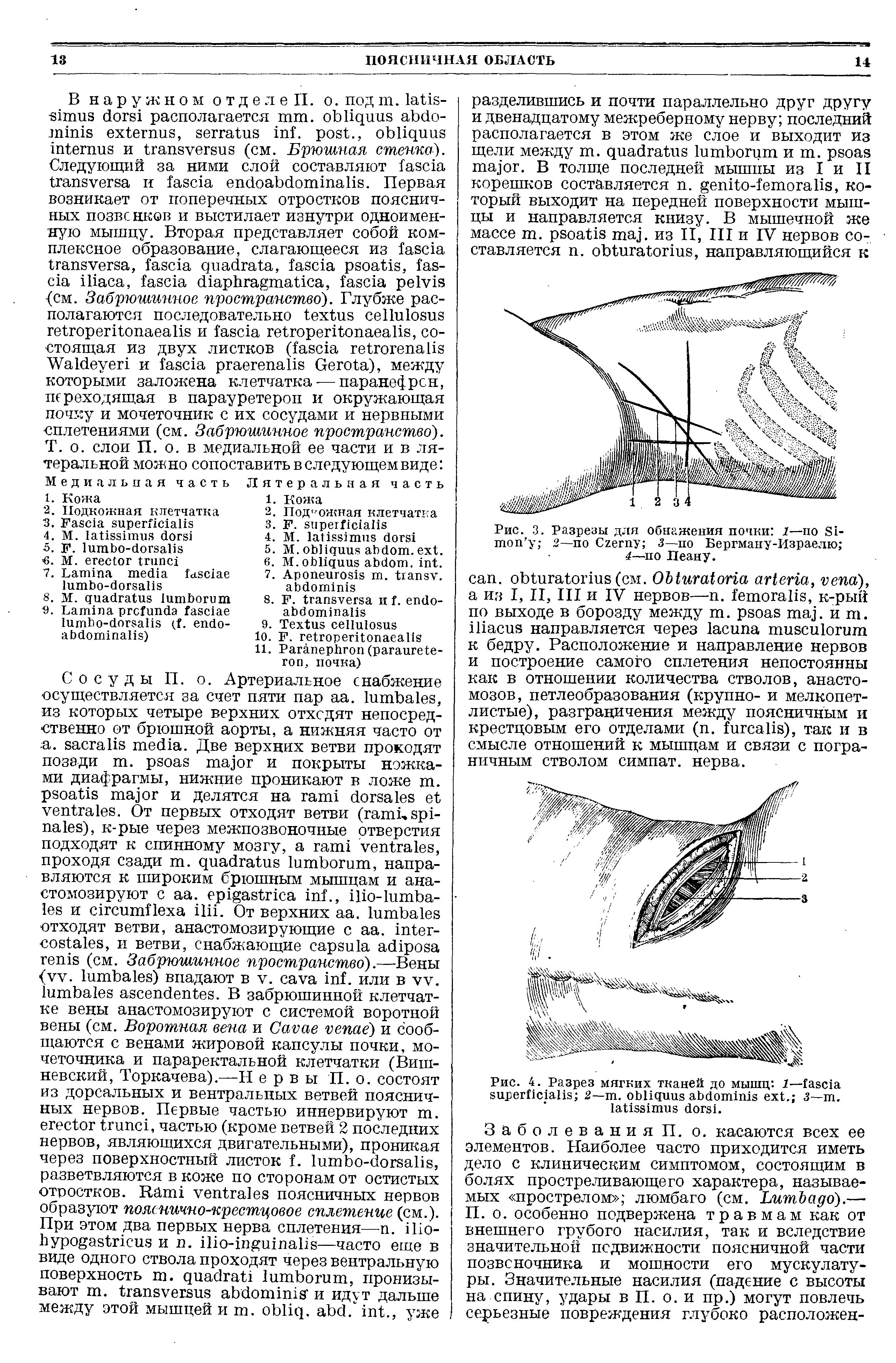 Рис. 3. Разрезы для обнажения почки 1—по S - 2—по C 3—по Бергману-Израелю 4—по Пеану.