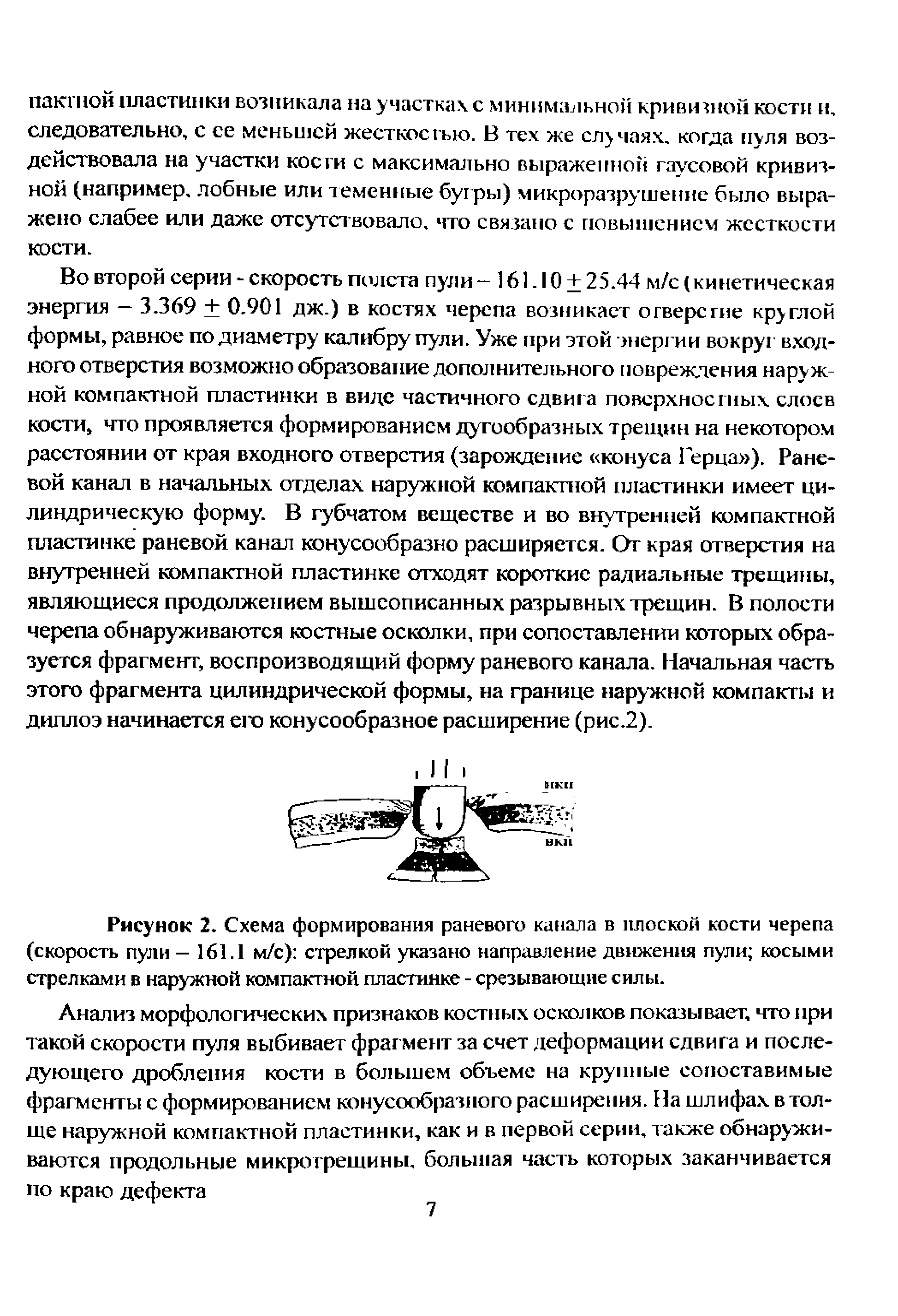 Рисунок 2. Схема формирования раневого канала в плоской кости черепа (скорость пули — 161.1 м/с) стрелкой указано направление движения пули косыми стрелками в наружной компактной пластинке - срезывающие силы.