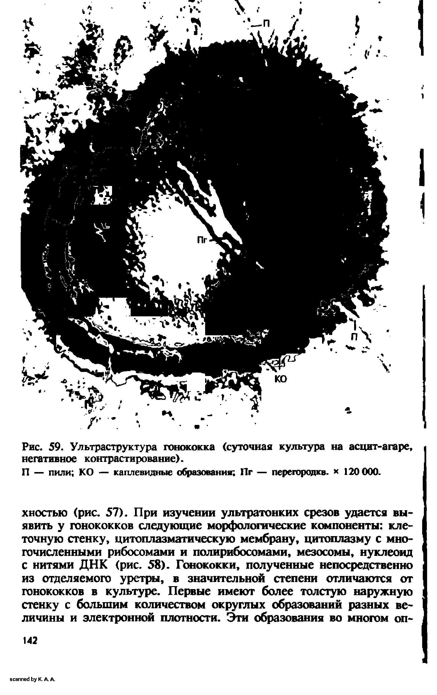 Рис. 59. Ультраструктура гонококка (суточная культура на асцит-агаре, негативное контрастирование).