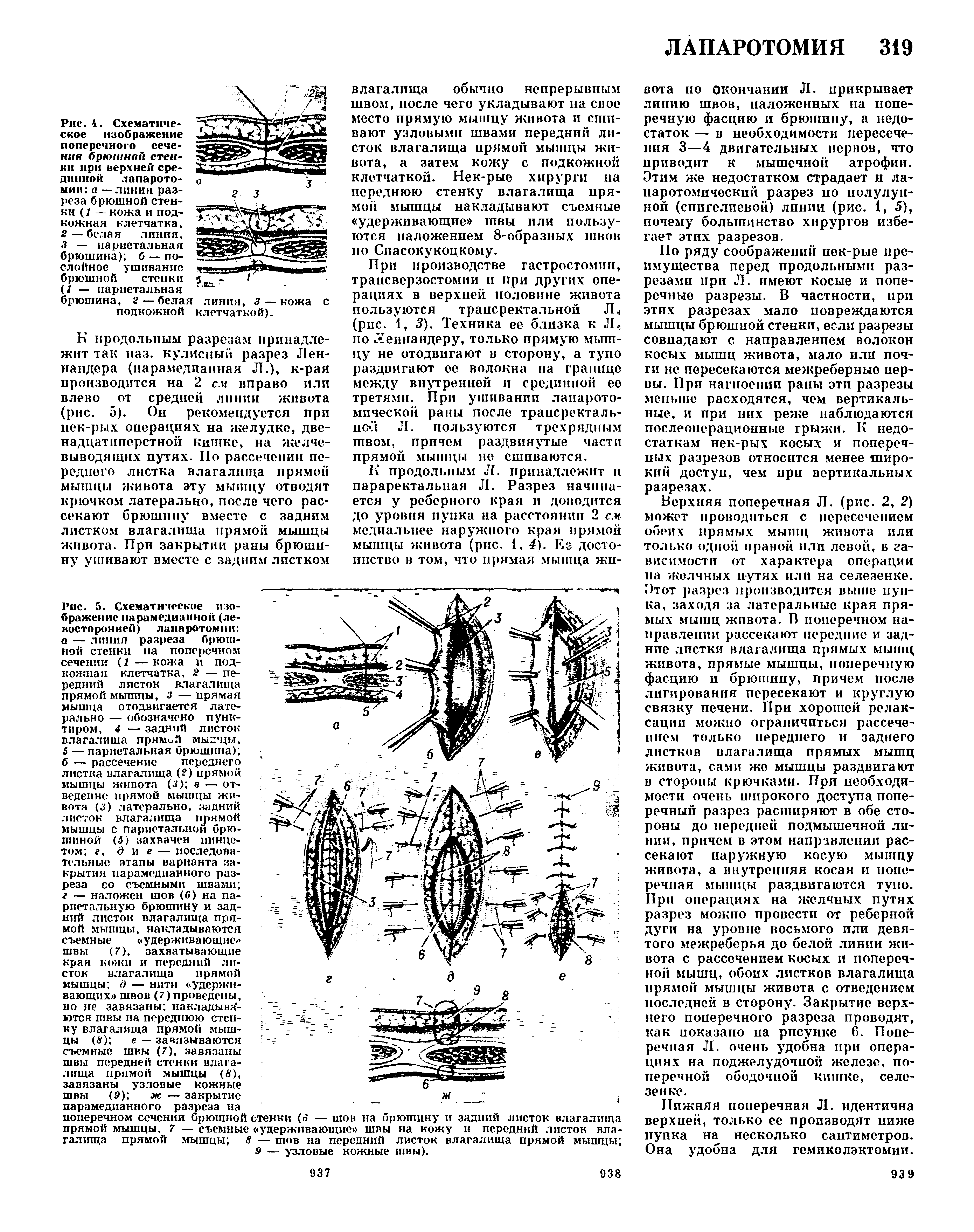 Рис. 5. Схематическое изображение парамедианной (левосторонней) лапаротомии а — линия разреза брюшной стенки на поперечном сечении (7 — кожа и подкожная клетчатка, 2 — передний листок влагалища прямой мышцы, 3 — прямая мышца отодвигается латерально — обозначено пунктиром, 4 — задний листок влагалища прямой мькгцы,...