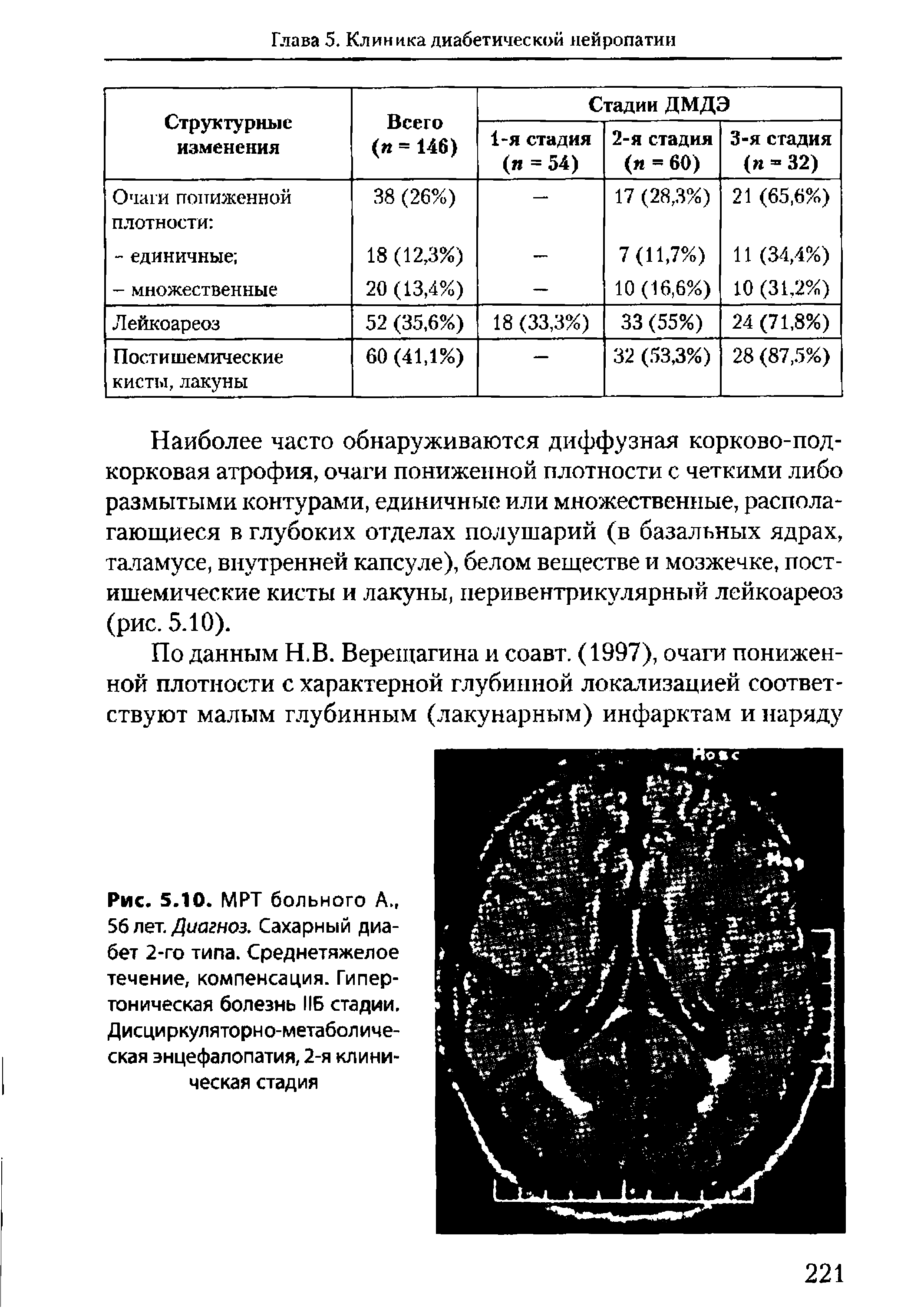 Рис. 5.10. МРТ больного А., 56 лет. Диагноз. Сахарный диабет 2-го типа. Среднетяжелое течение, компенсация. Гипертоническая болезнь НБ стадии. Дисциркуляторно-метаболическая энцефалопатия, 2-я клиническая стадия...