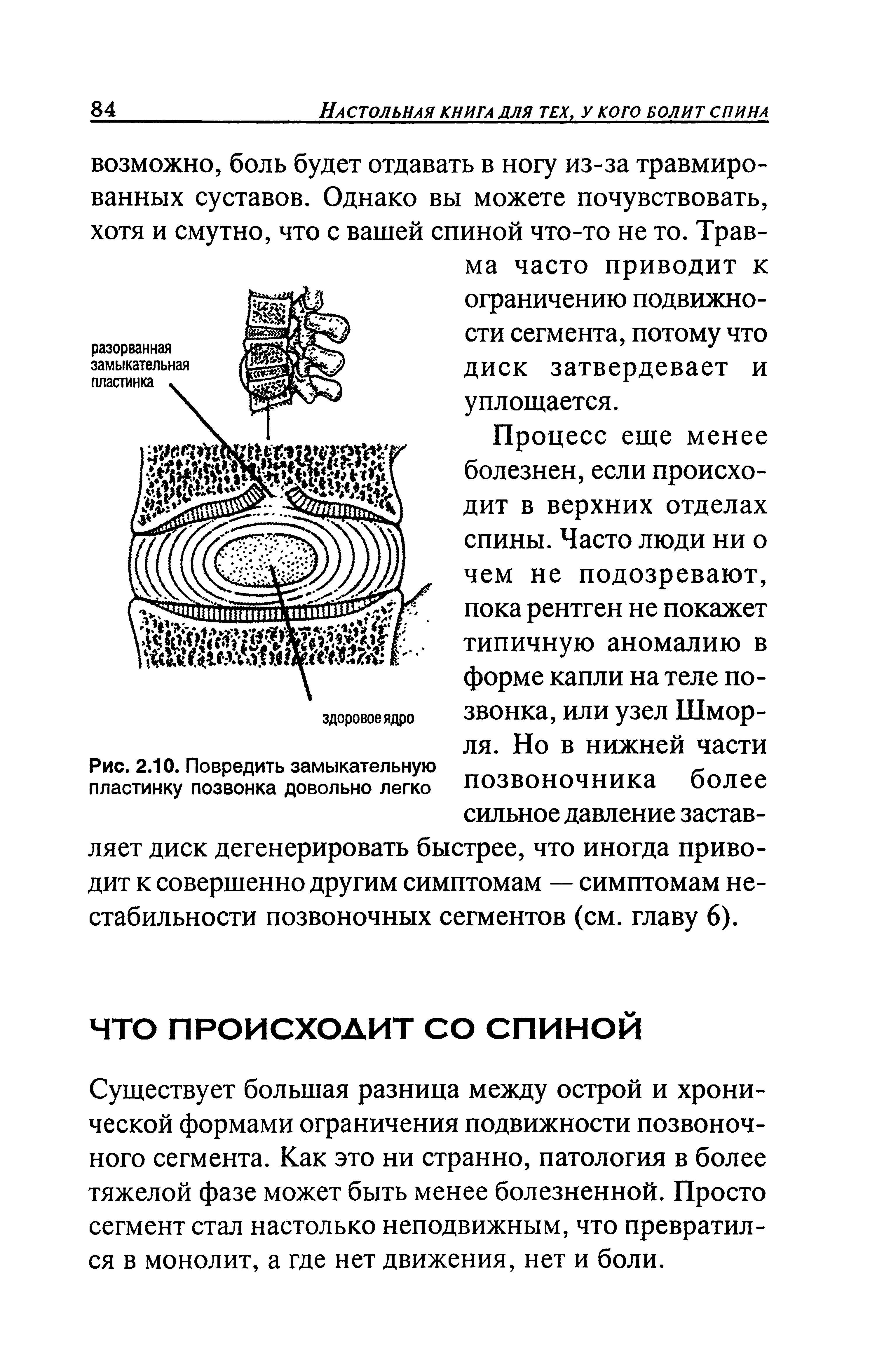 Рис. 2.10. Повредить замыкательную пластинку позвонка довольно легко...