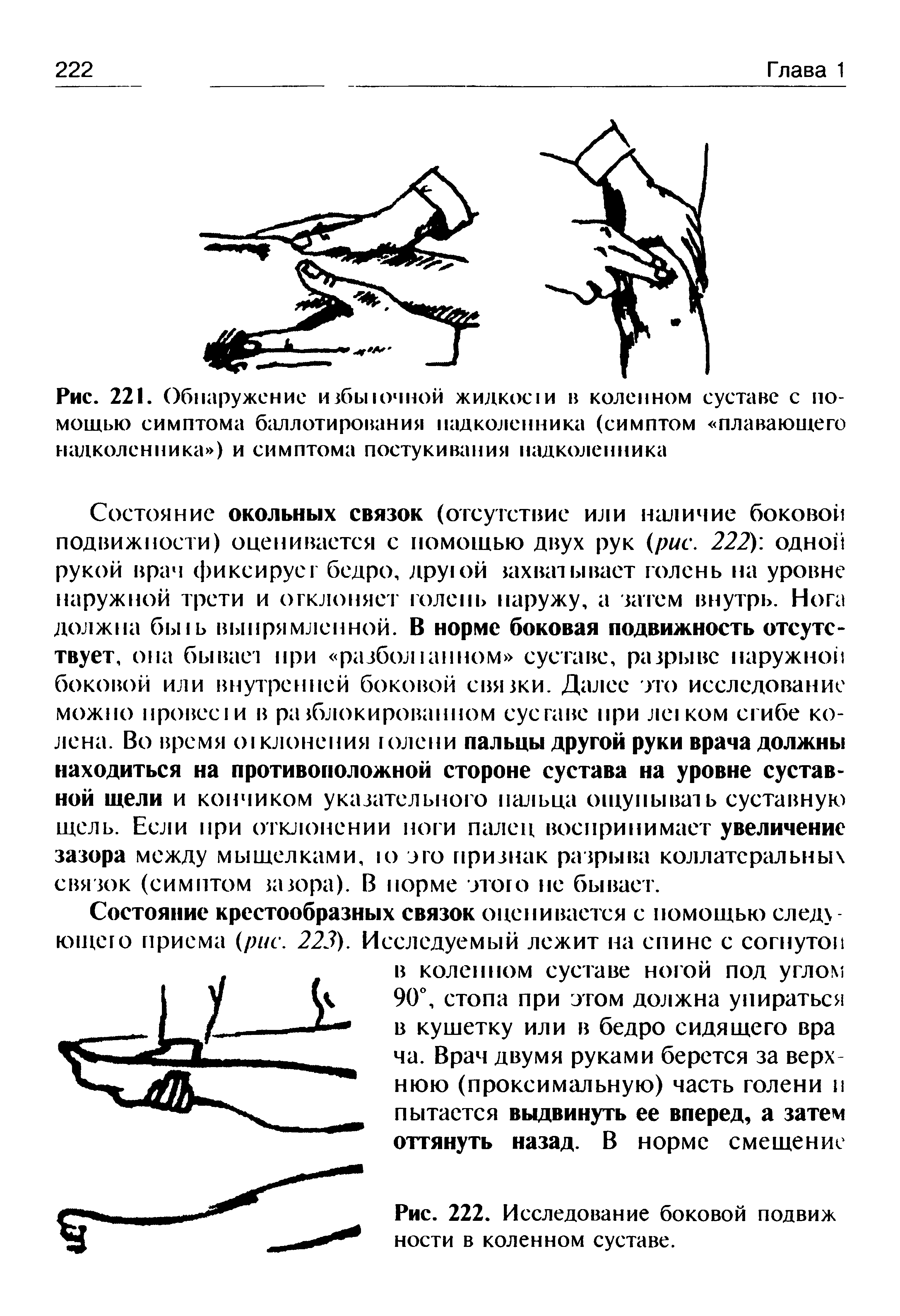 Рис. 221. Обнаружение избыючной жидкое и в коленном суставе с помощью симптома баллотирования надколенника (симптом плавающего надколенника ) и симптома постукивания надколенника...