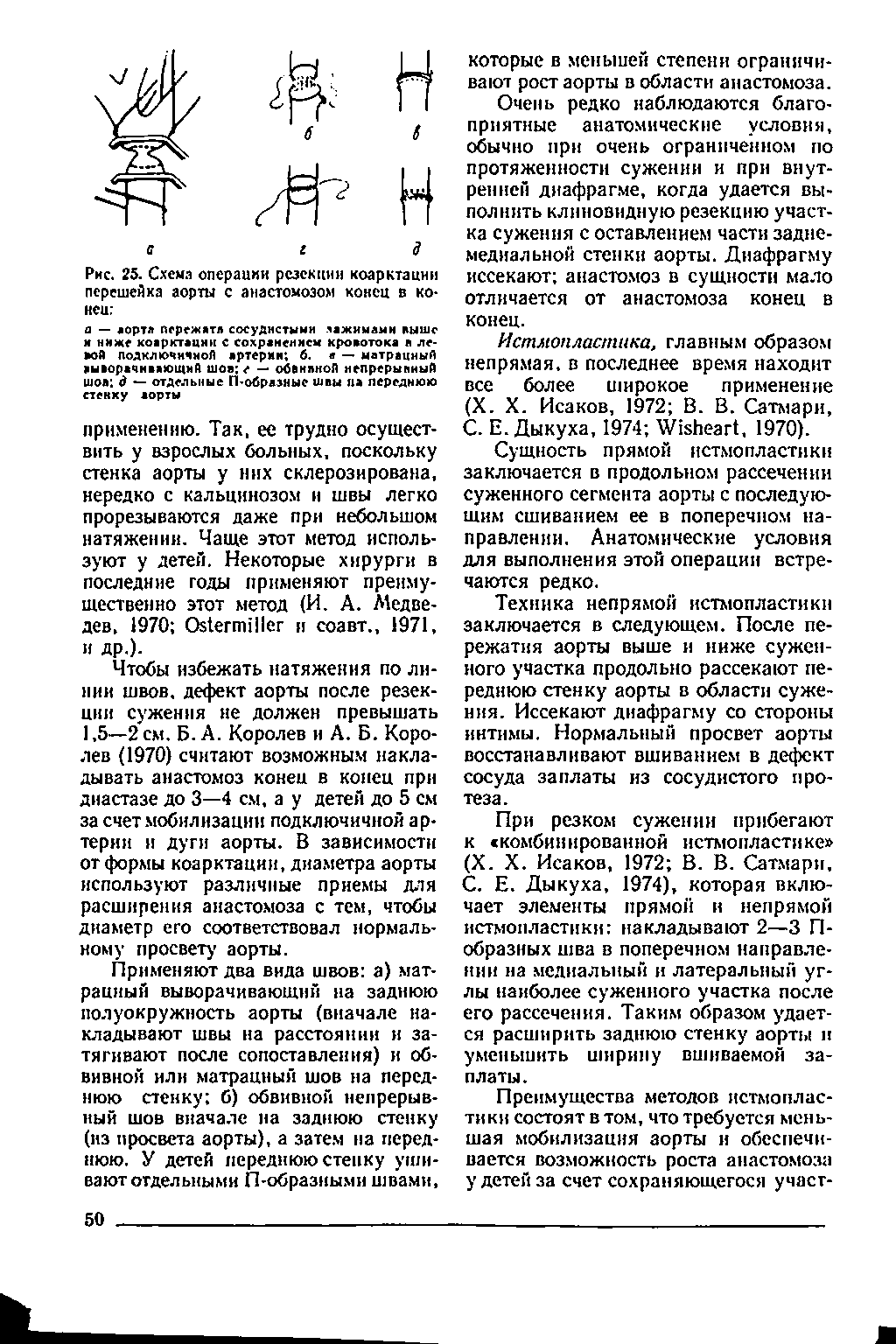 Рис. 25. Схема операции резекции коарктации перешейка аорты с анастомозом конец в коней ...