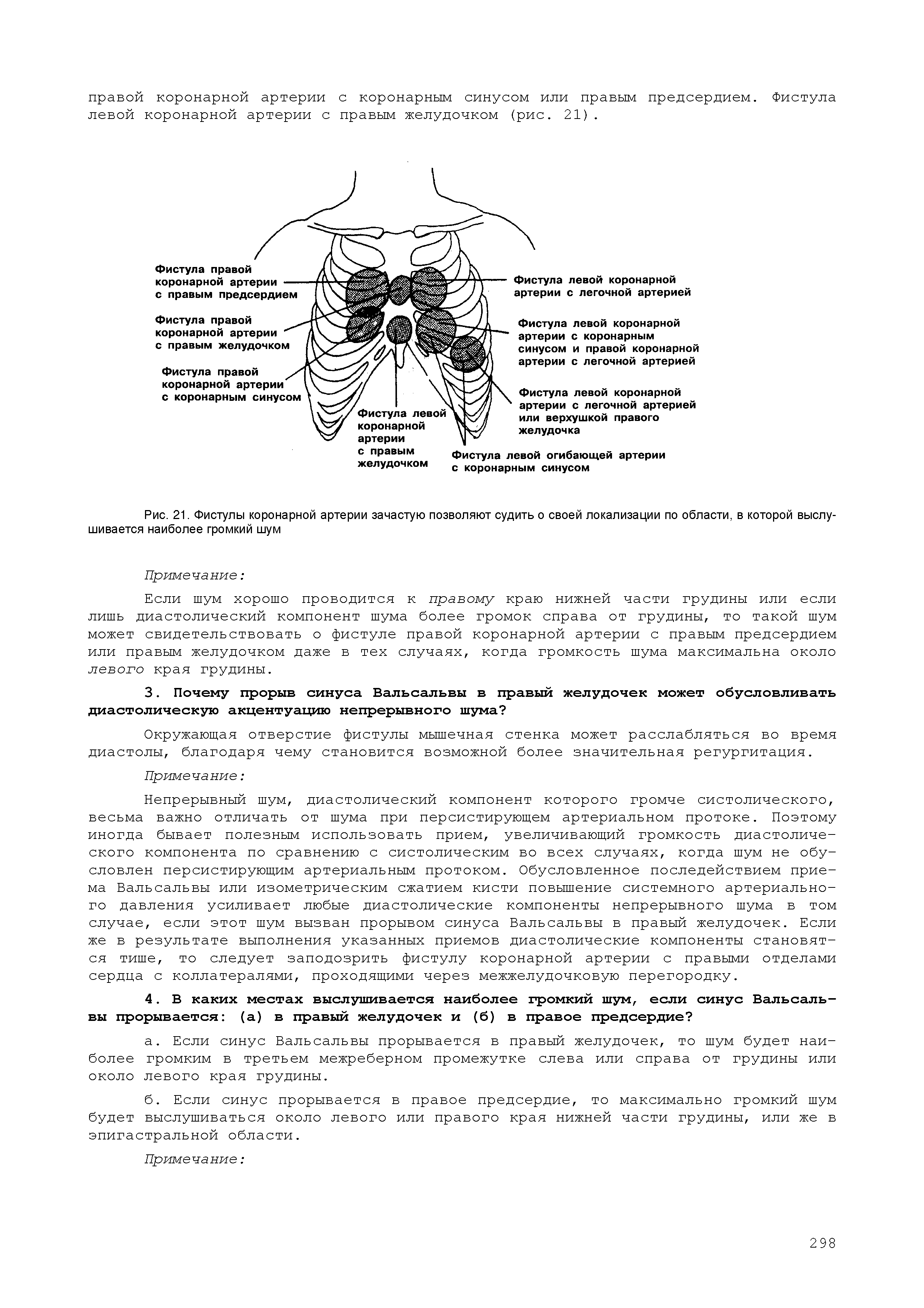 Рис. 21. Фистулы коронарной артерии зачастую позволяют судить о своей локализации по области, в которой выслушивается наиболее громкий шум...