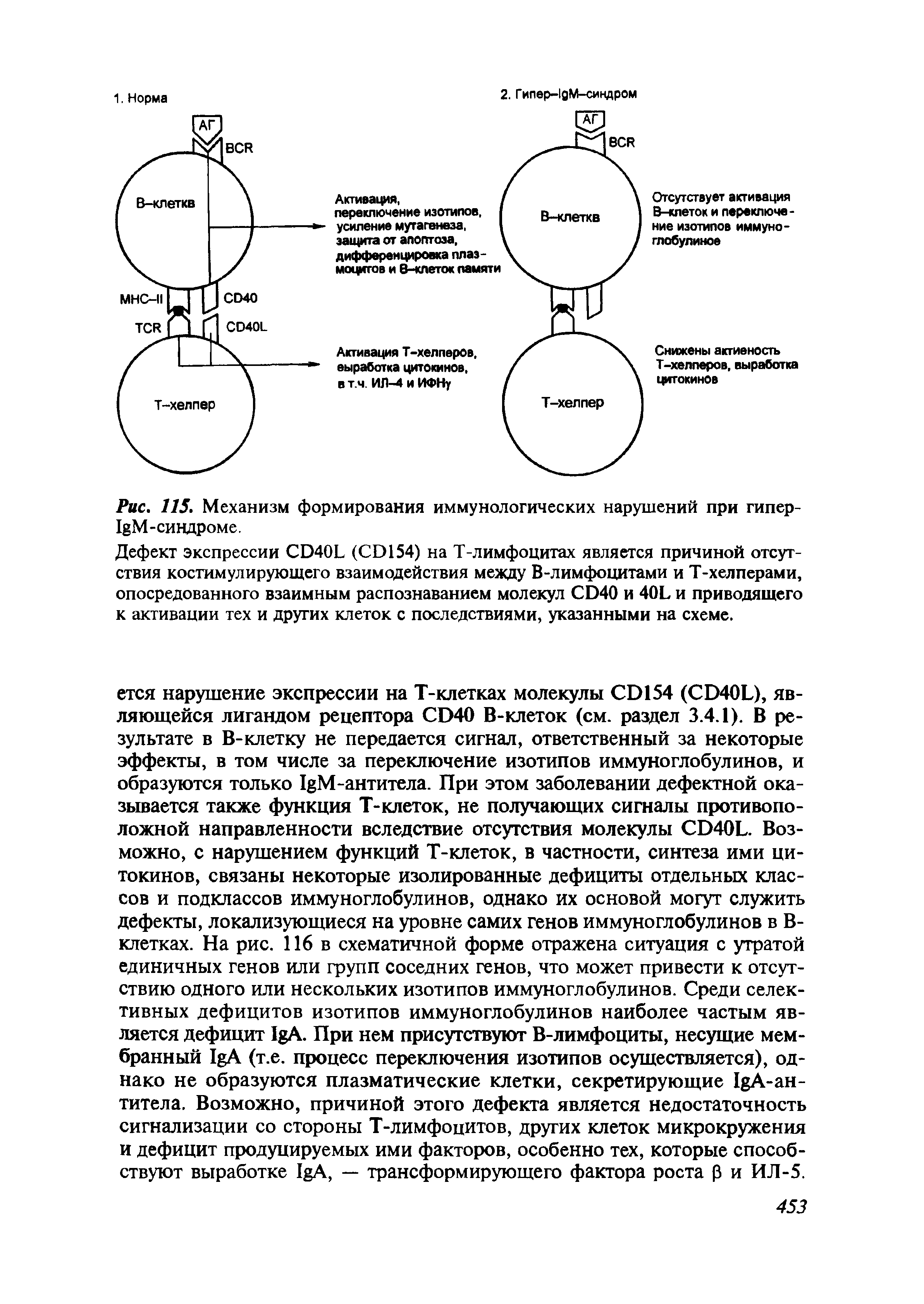 Рис. 115. Механизм формирования иммунологических нарушений при гипер-I M-синдроме.