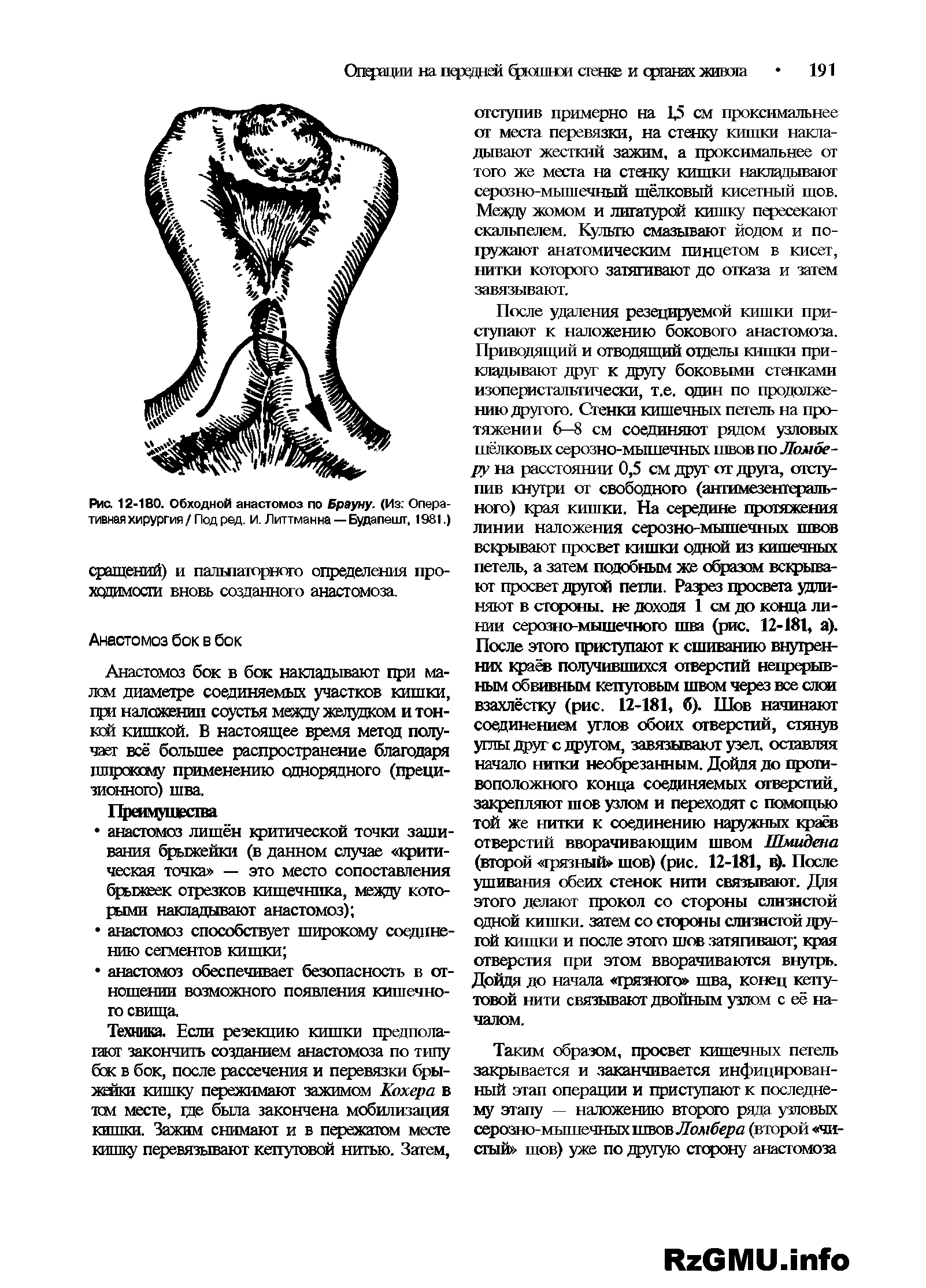 Рис. 12-180. Обходной анастомоз по Брауну. (Из Оперативная хирургия / Под ред. и. Литтманна —Будапешт, 1981.)...