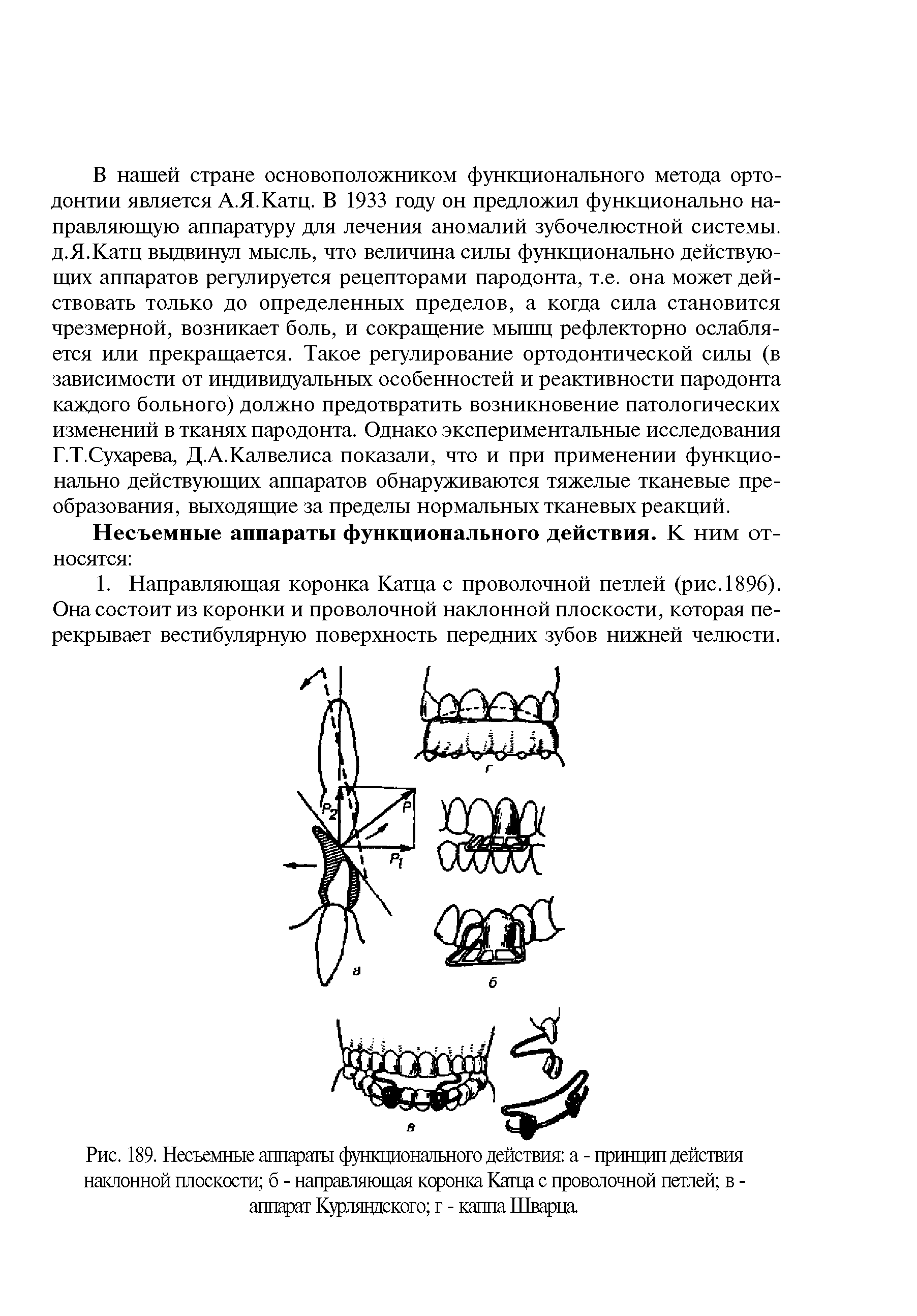 Рис. 189. Несъемные аппараты функционального действия а - принцип действия наклонной плоскости б - направляющая коронка Катца с проволочной петлей в -аппарат Курляндского г - каппа Шварца...