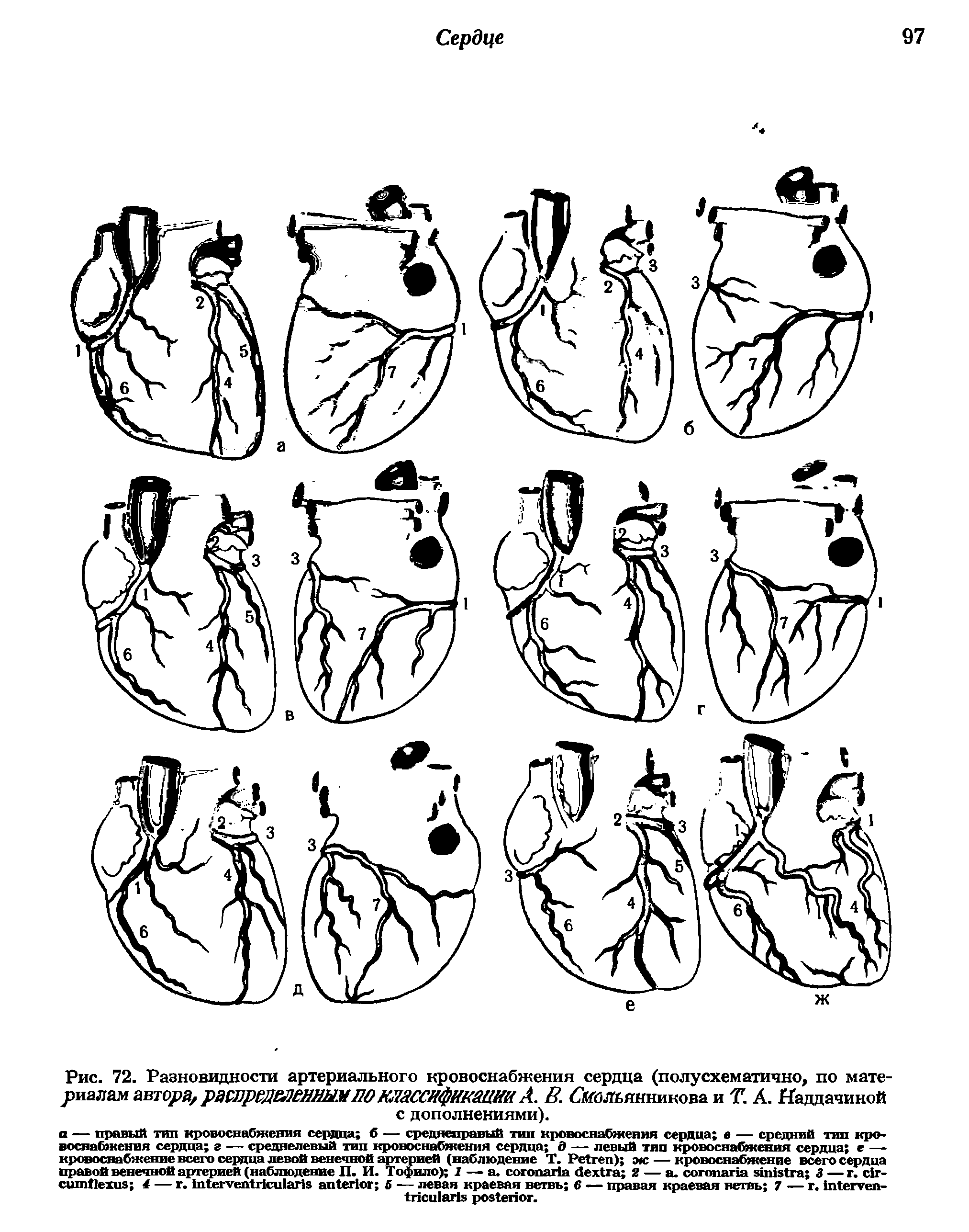 Рис. 72. Разновидности артериального кровоснабжения сердца (полусхематично, по материалам автора, распределенным ПО классификации А. В. бкбльянникова и Т. . Наддачиной с дополнениями).