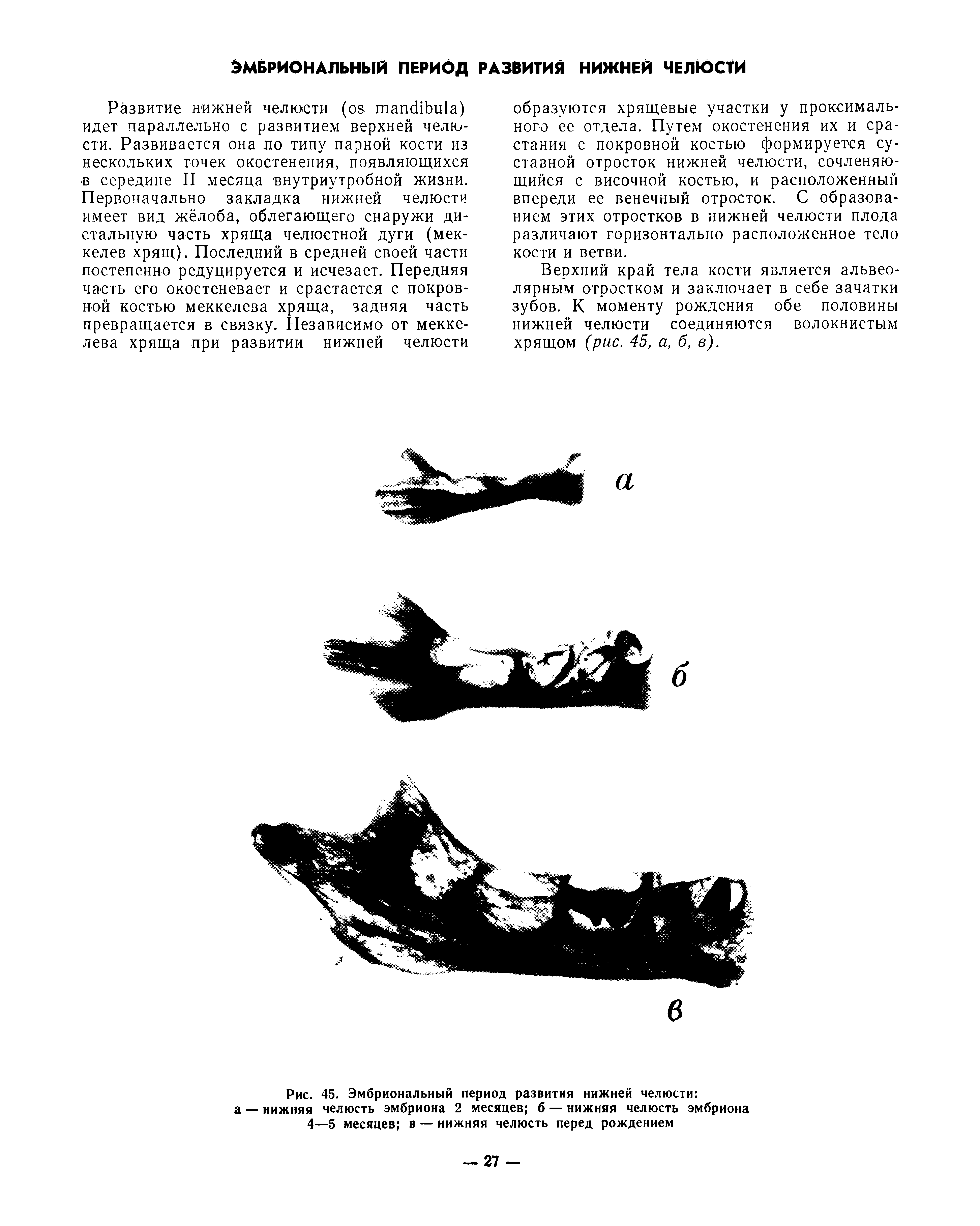 Рис. 45. Эмбриональный период развития нижней челюсти а — нижняя челюсть эмбриона 2 месяцев б — нижняя челюсть эмбриона 4—5 месяцев в — нижняя челюсть перед рождением...