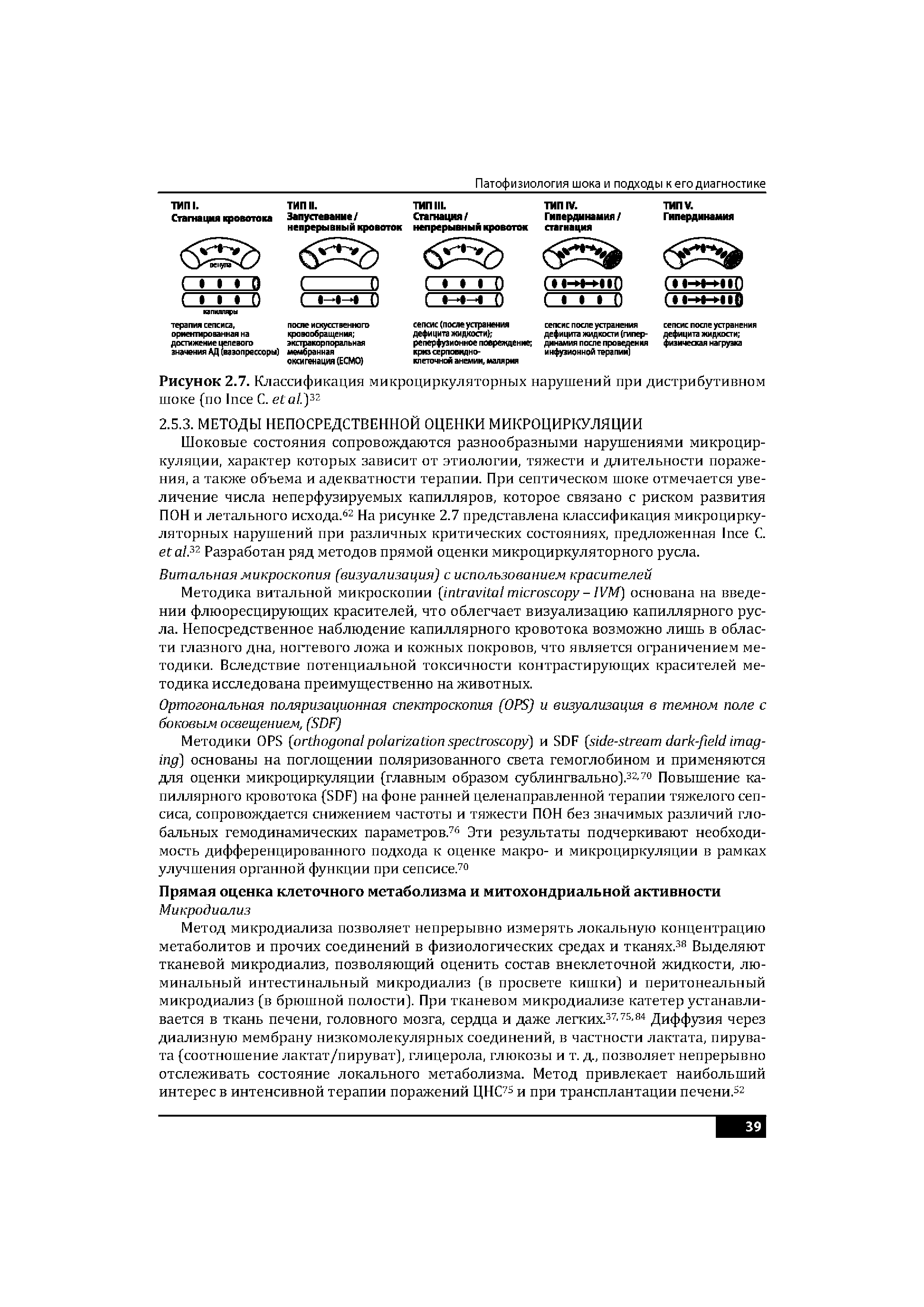 Рисунок 2.7. Классификация микроциркуляторных нарушений при дистрибутивном шоке (по I С. . 32...