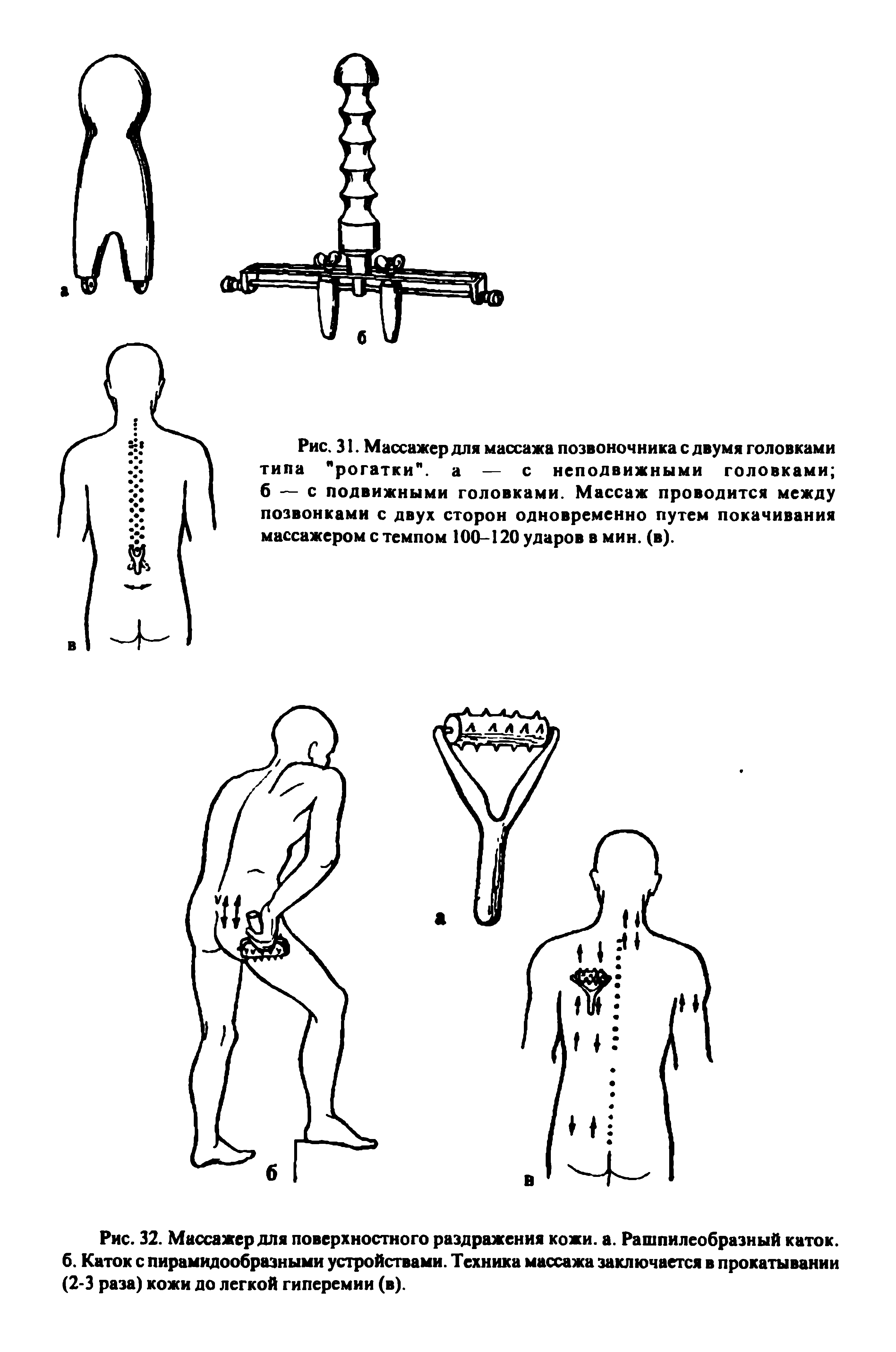 Рис. 32. Массажер для поверхностного раздражения кожи. а. Рашпилеобразный каток, б. Каток с пирамидообразными устройствами. Техника массажа заключается в прокатывании (2-3 раза) кожи до легкой гиперемии (в).