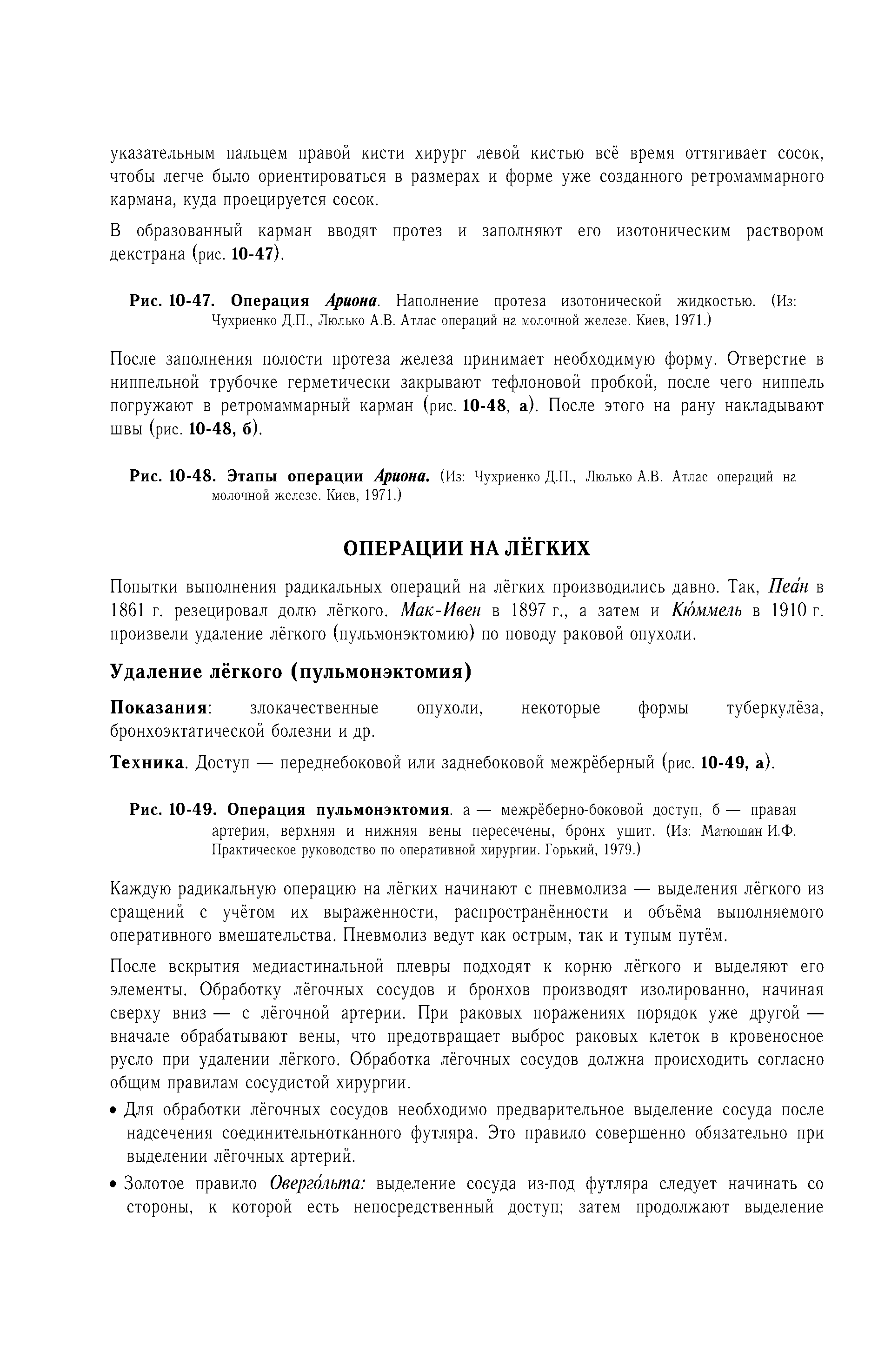 Рис. 10-49. Операция пульмонэктомия. а — межрёберно-боковой доступ, б — правая артерия, верхняя и нижняя вены пересечены, бронх ушит. (Из Матюшин И.Ф. Практическое руководство по оперативной хирургии. Горький, 1979.)...