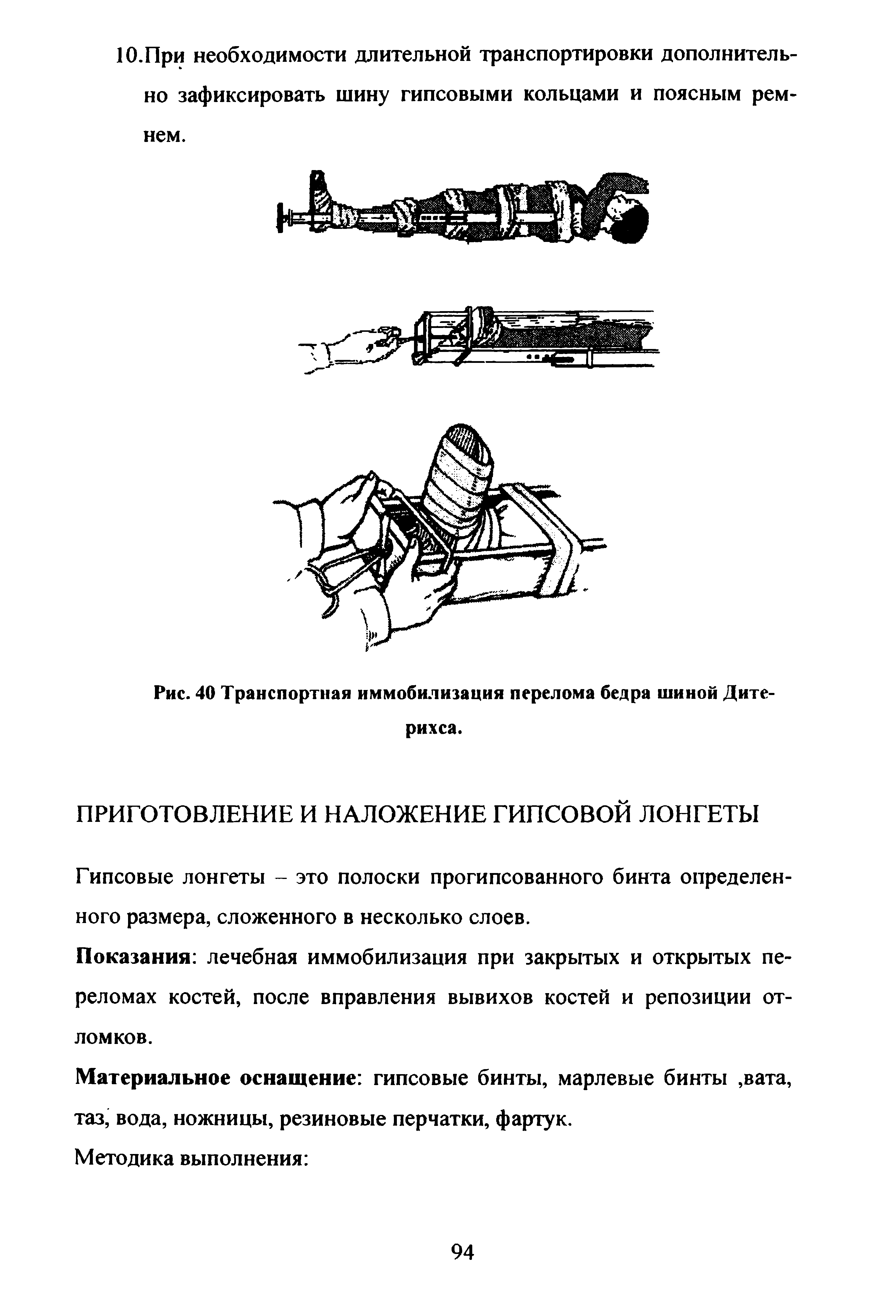 Рис. 40 Транспортная иммобилизация перелома бедра шиной Дите-рихса.