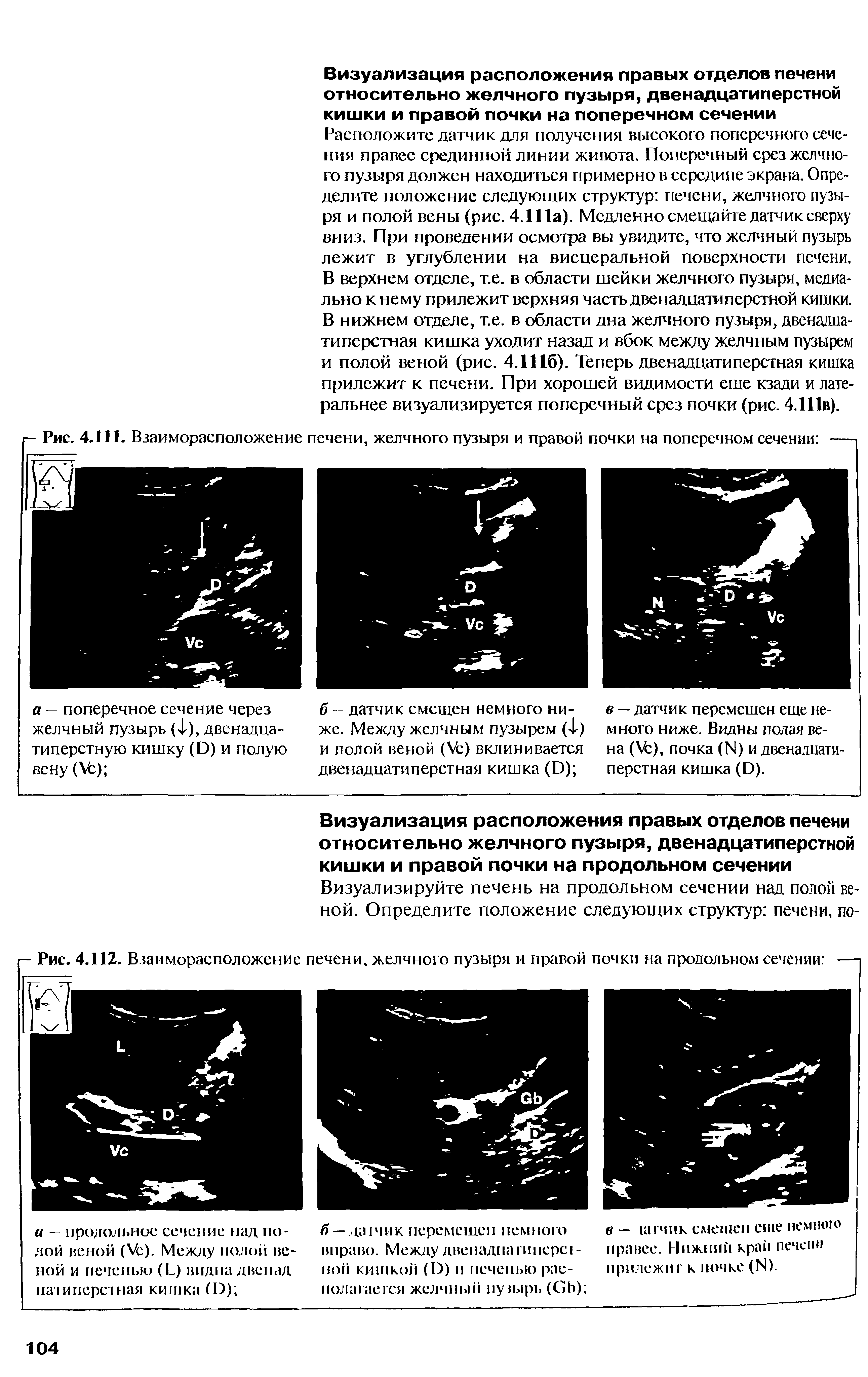 Рис. 4.111. Взаиморасположение печени, желчного пузыря и правой почки на поперечном сечении ...