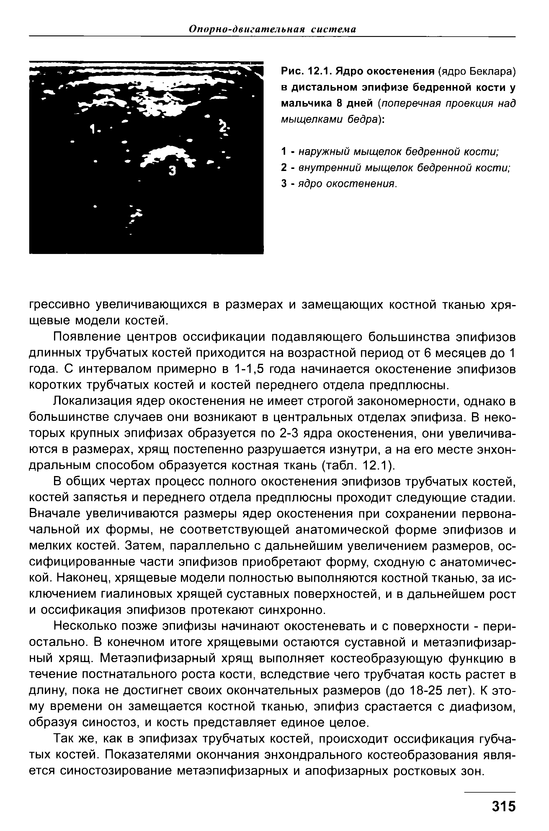 Рис. 12.1. Ядро окостенения (ядро Беклара) в дистальном эпифизе бедренной кости у мальчика 8 дней (поперечная проекция над мыщелками бедра) ...