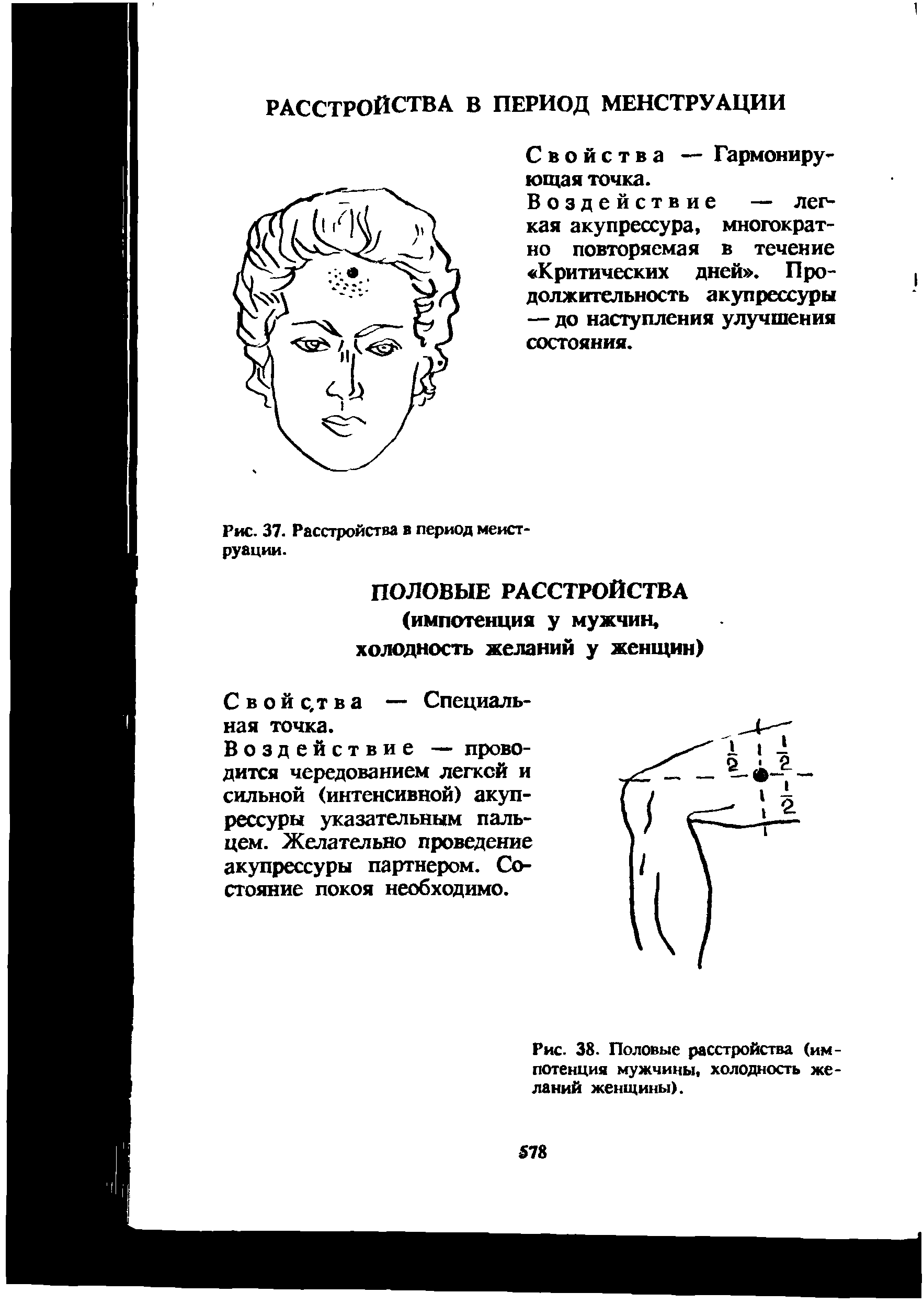 Рис. 38. Половые расстройства (импотенция мужчины, холодность желаний женщины).