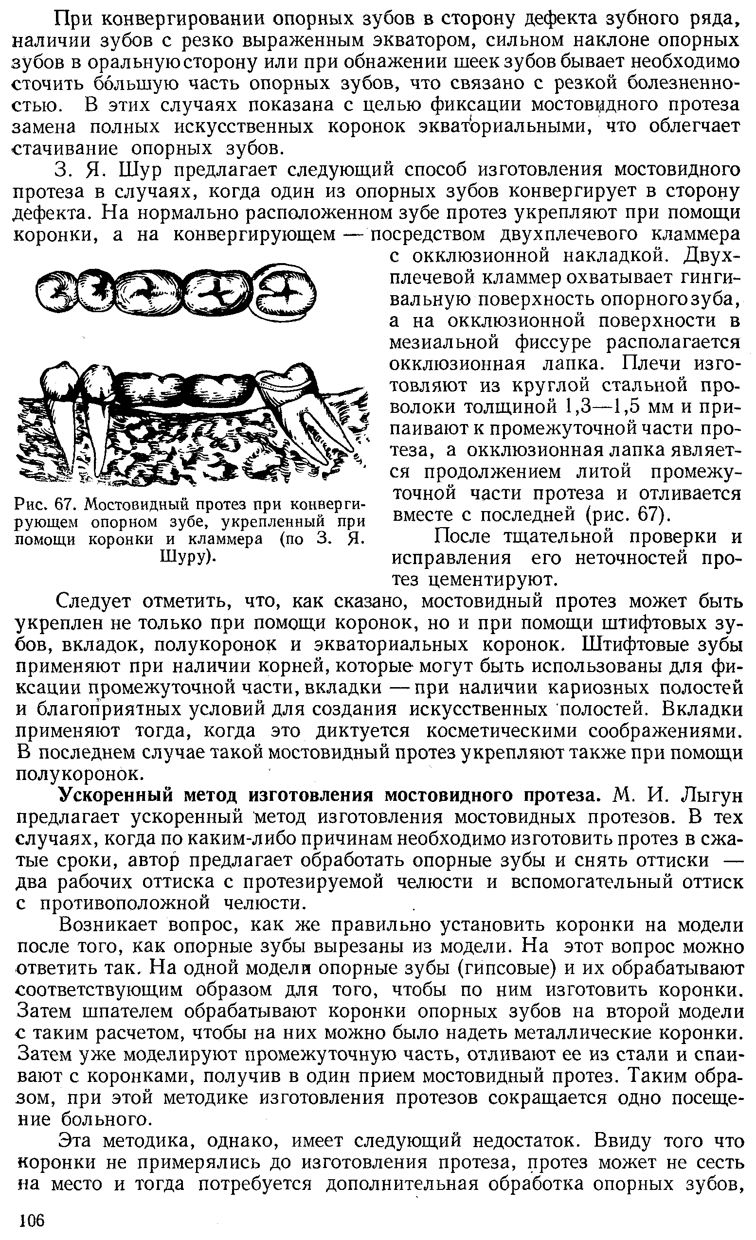 Рис. 67. Мостовидный протез при конвергирующем опорном зубе, укрепленный при помощи коронки и кламмера (по 3. Я-Шуру).