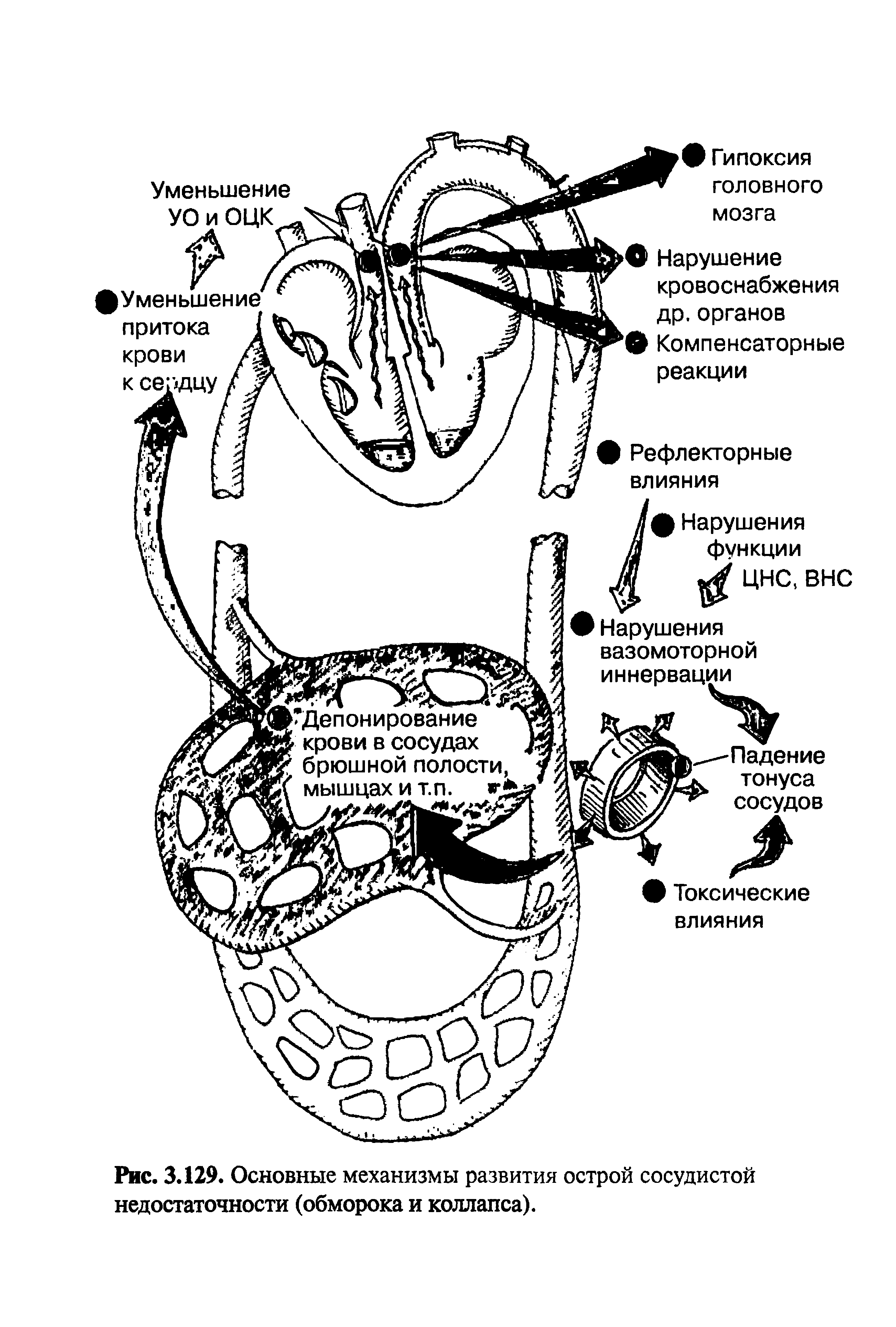 Рис. 3.129. Основные механизмы развития острой сосудистой недостаточности (обморока и коллапса).