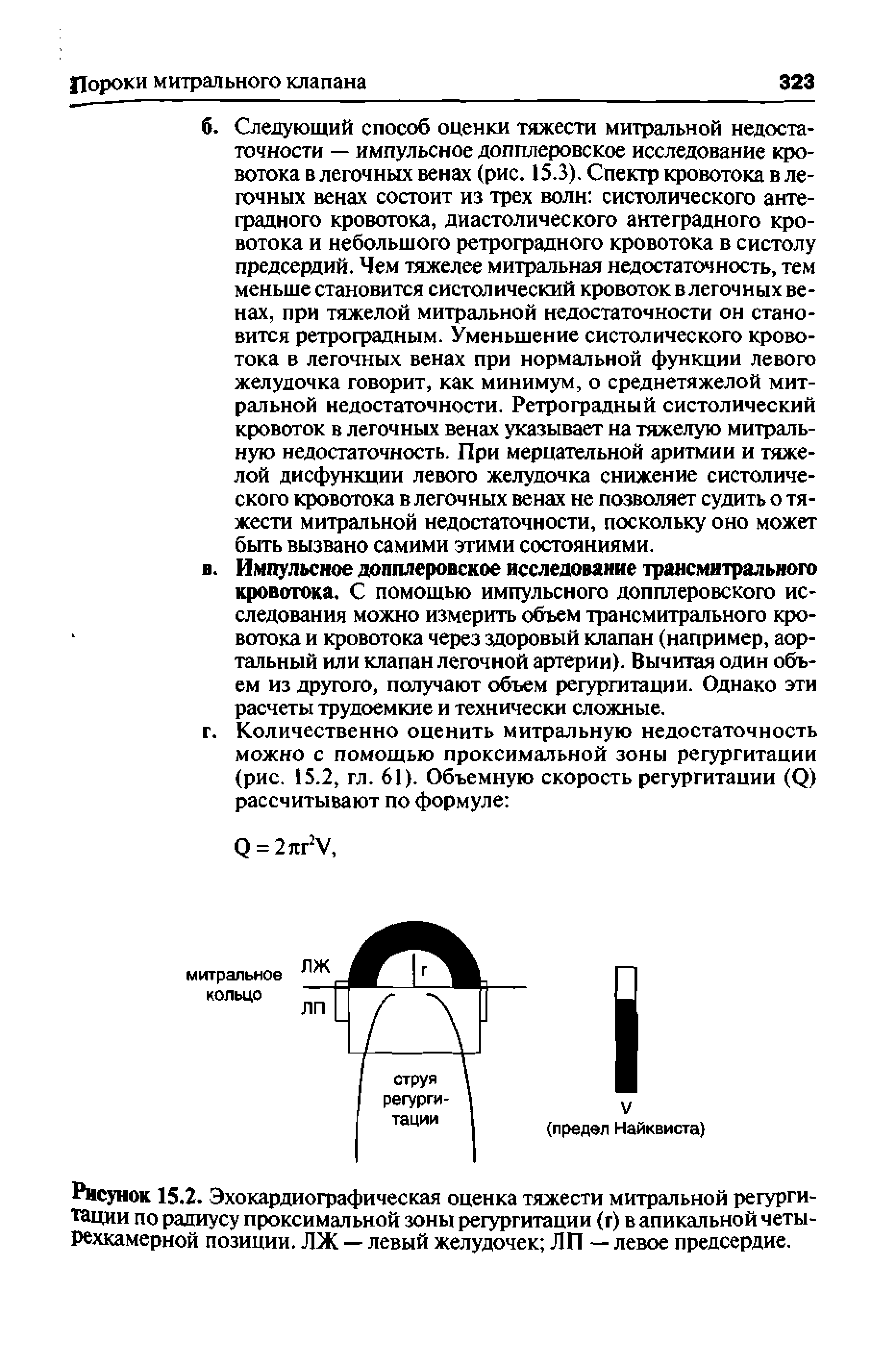 Рисунок 15.2. Эхокардиографическая оценка тяжести митральной регургитации по радиусу проксимальной зоны регургитации (г) в апикальной четырехкамерной позиции. ЛЖ — левый желудочек ЛП — левое предсердие.