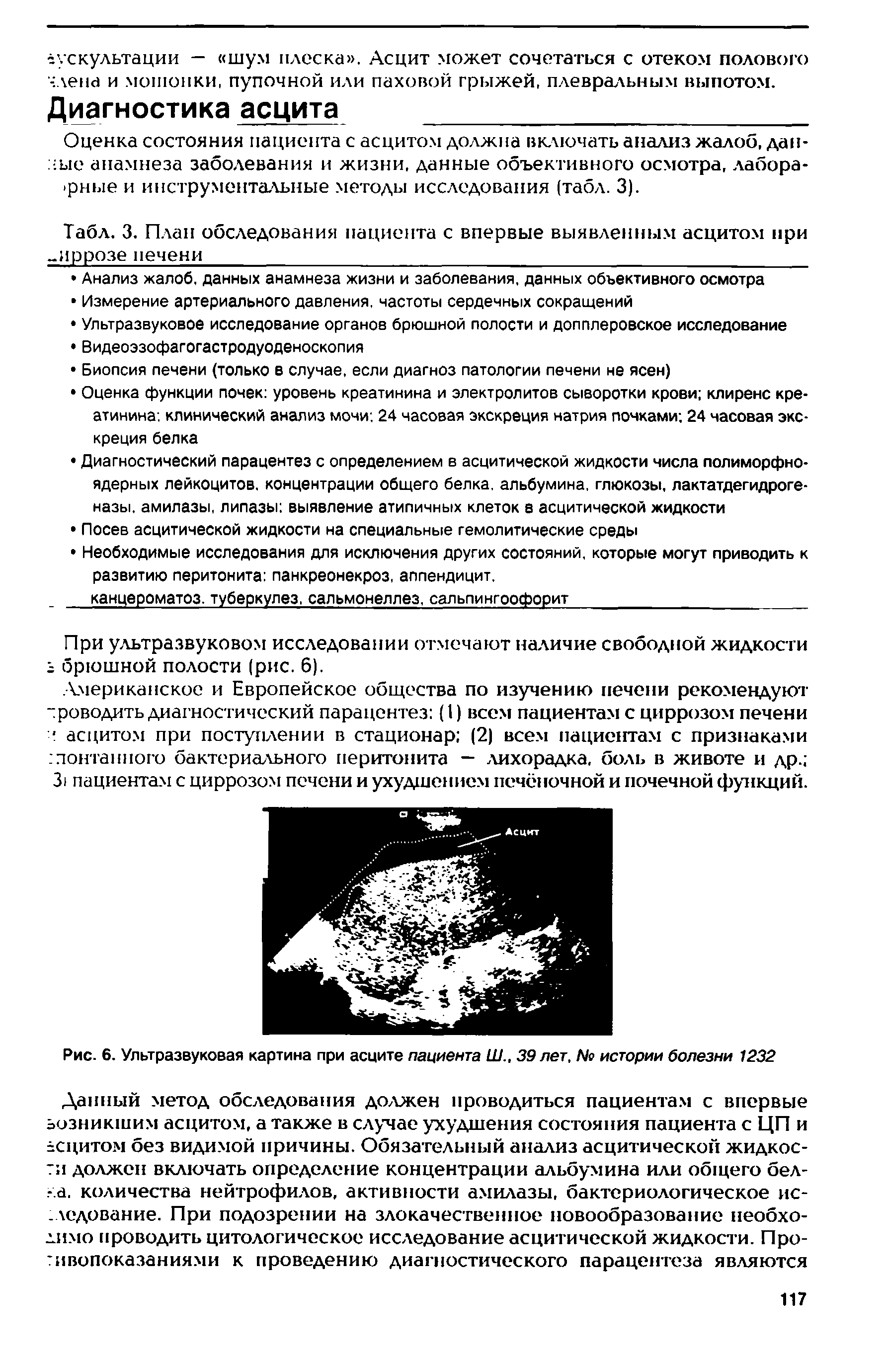 Табл. 3. План обследования пациента с впервые выявленным асцитом при иррозе печени ...